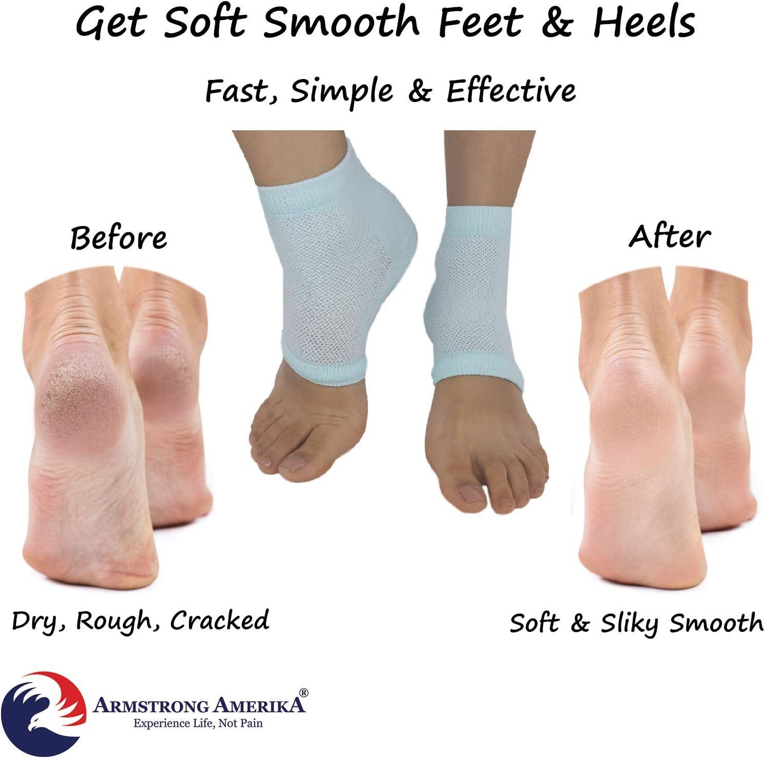 At-Home Dry Feet Treatment - Moisturizing Heel Socks - Pain-Free Feet - 2  Pairs | eBay