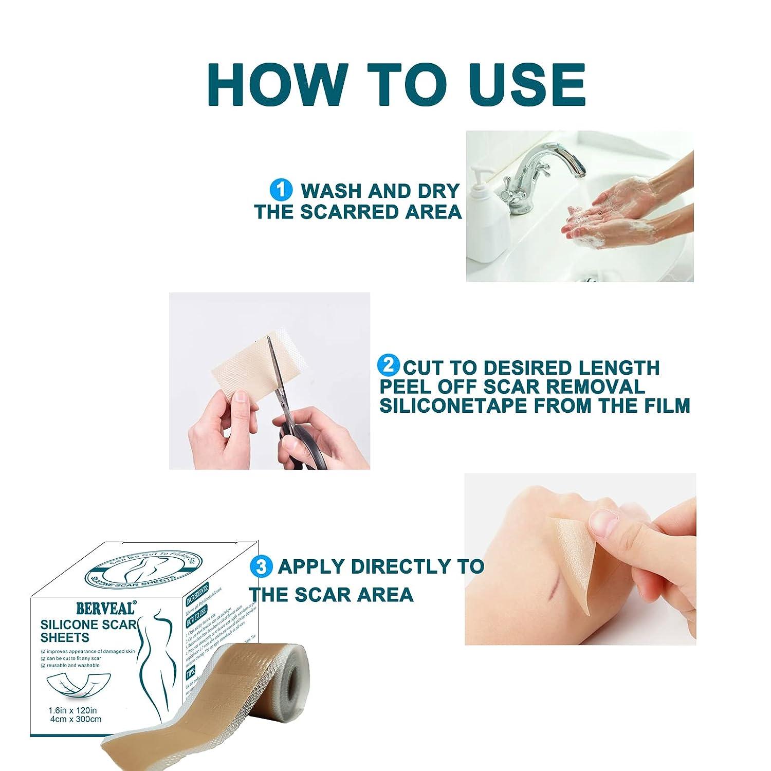 Instruction for use silicone hand - Scarban (EU)