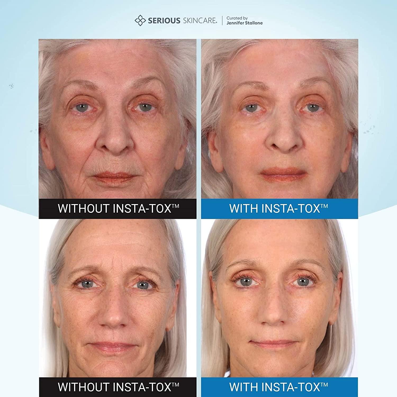 Serious Skincare Insta Tox Wrinkle Smoothing Serum Serious Skincare Insta-TOX Instant Wrinkle Smoothing Serum - Tightens