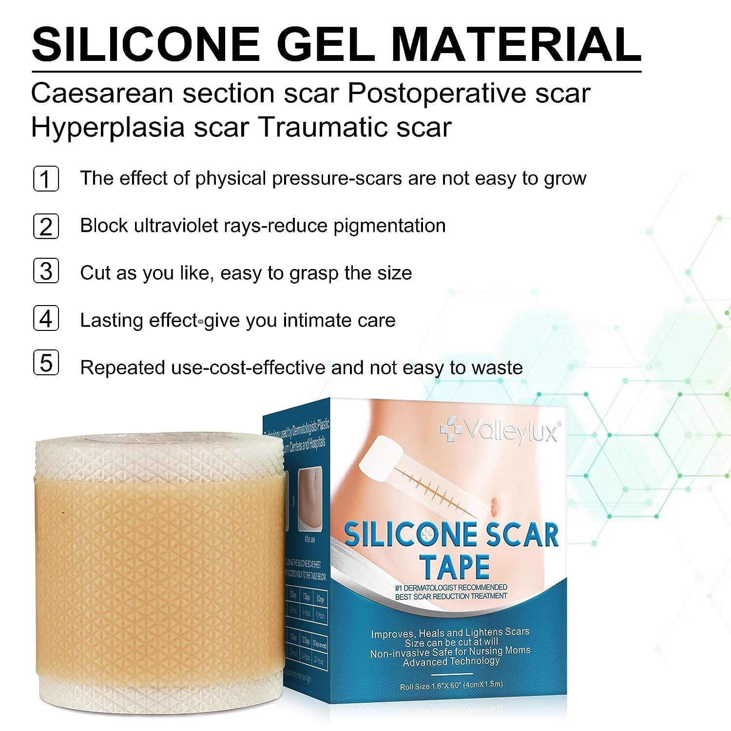 Silicone Scar Tape Medical Grade - 1.6 X 120 Inch Roll For Surgical & C-Section Scars Tuck Tape - View #9