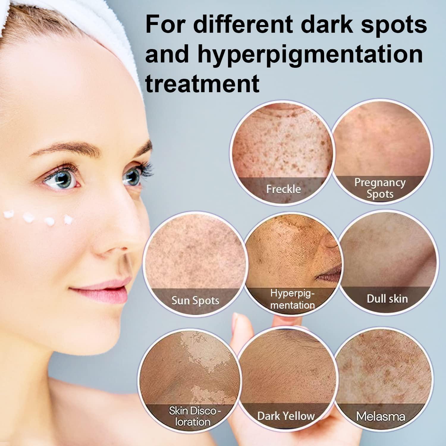 Dark Spot Remover Face, Treatment, Melasma, Freckle, Sun Removal for All Skin Dark Spot Corrector for Men and Women