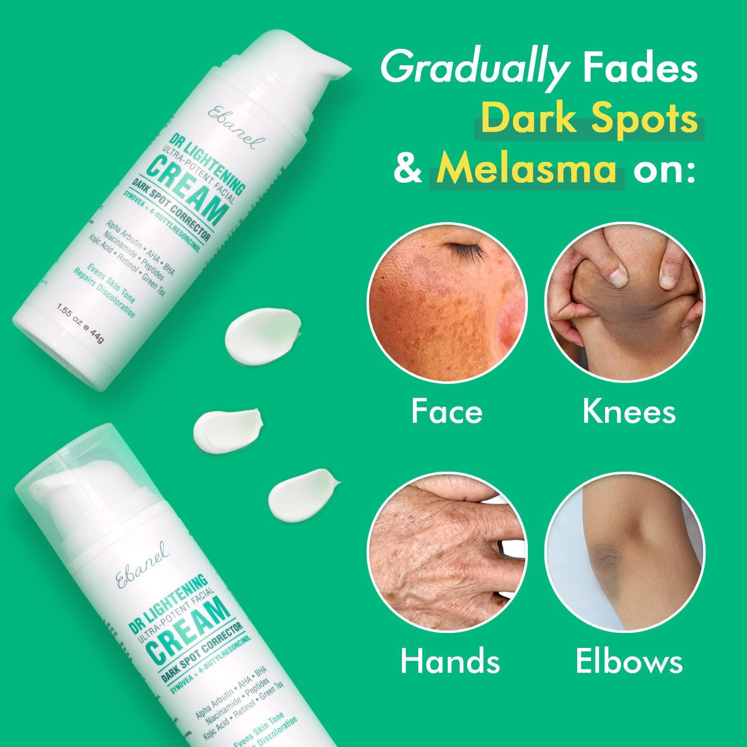 Ebanel Dark Spot Remover for Face Peel Skin Brightening Cream Melasma