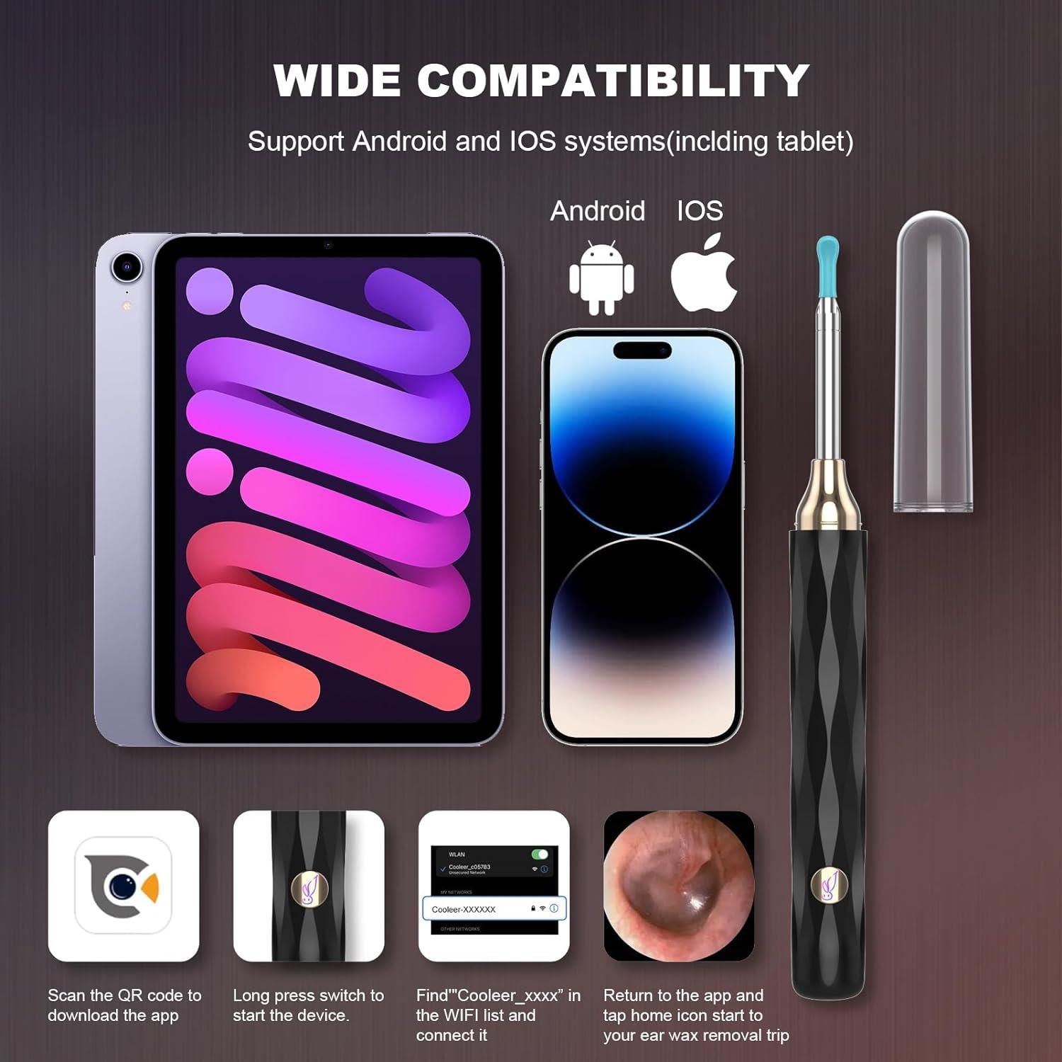 Ear Wax Removal Camera, Kekoy Ear Cleaner 1296P HD Camera, Ear Cleaning