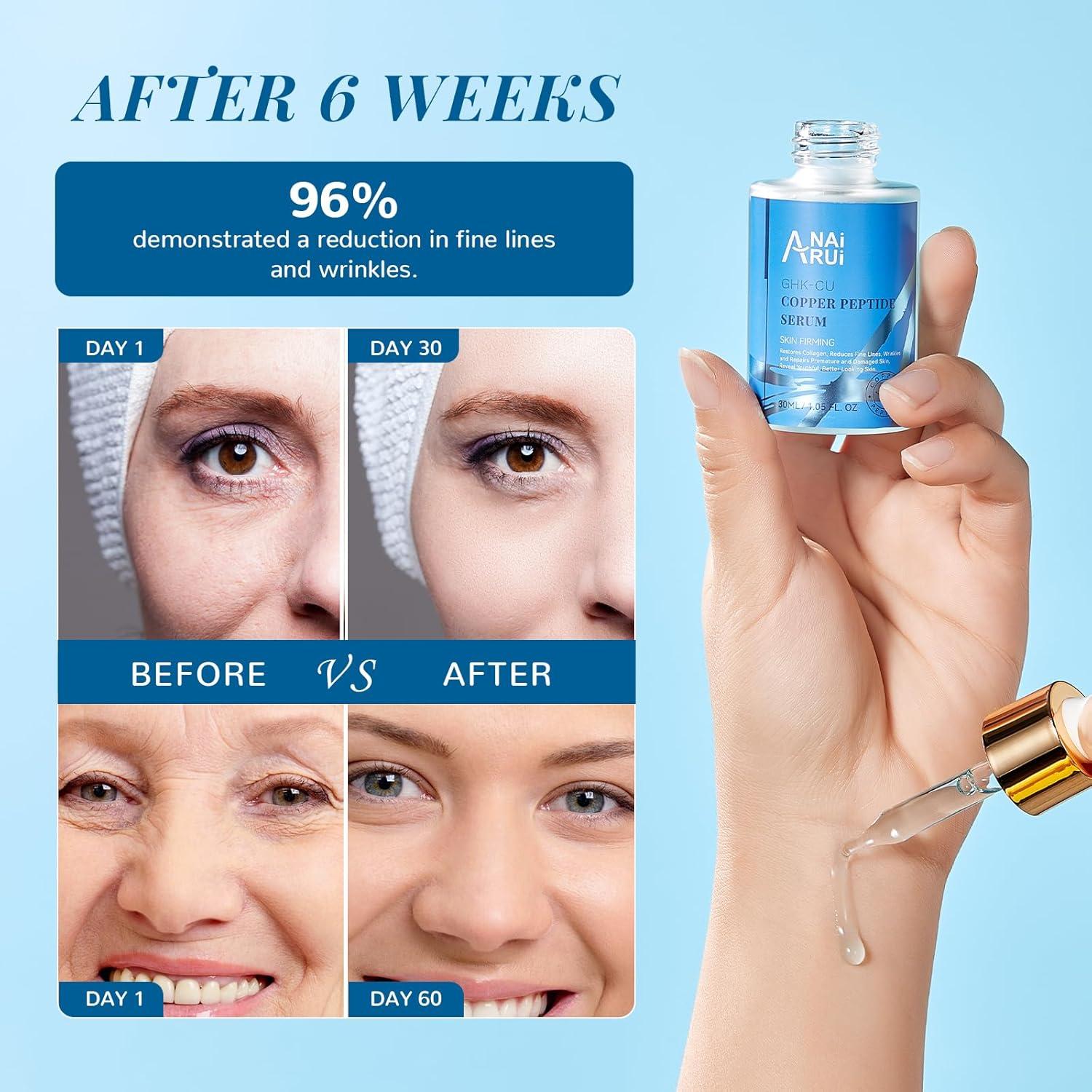 ghk cu peptide skin before and after GHK-Cu Peptide Therapy Connecticut main image 0