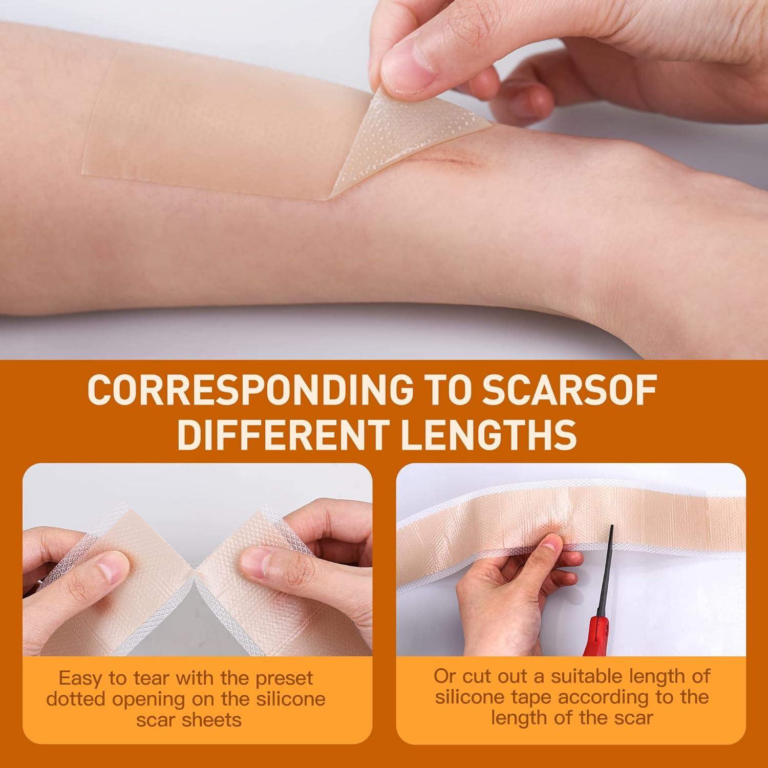 Medical Grade Silicone Scar Sheets Breathable Silicone Scar Tape Roll