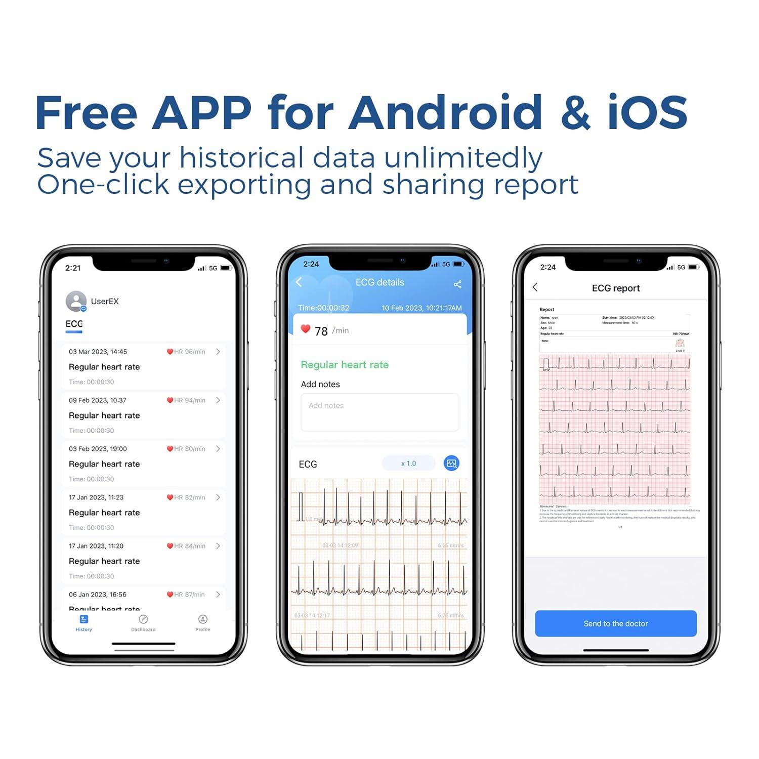 ViATOM Pulsebit-EX ECG Monitor: Bluetooth EKG Device for iOS