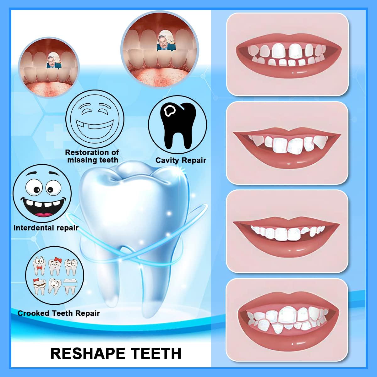 Tooth Repair Kit Includes 3 Moldable Denture Option That Can
