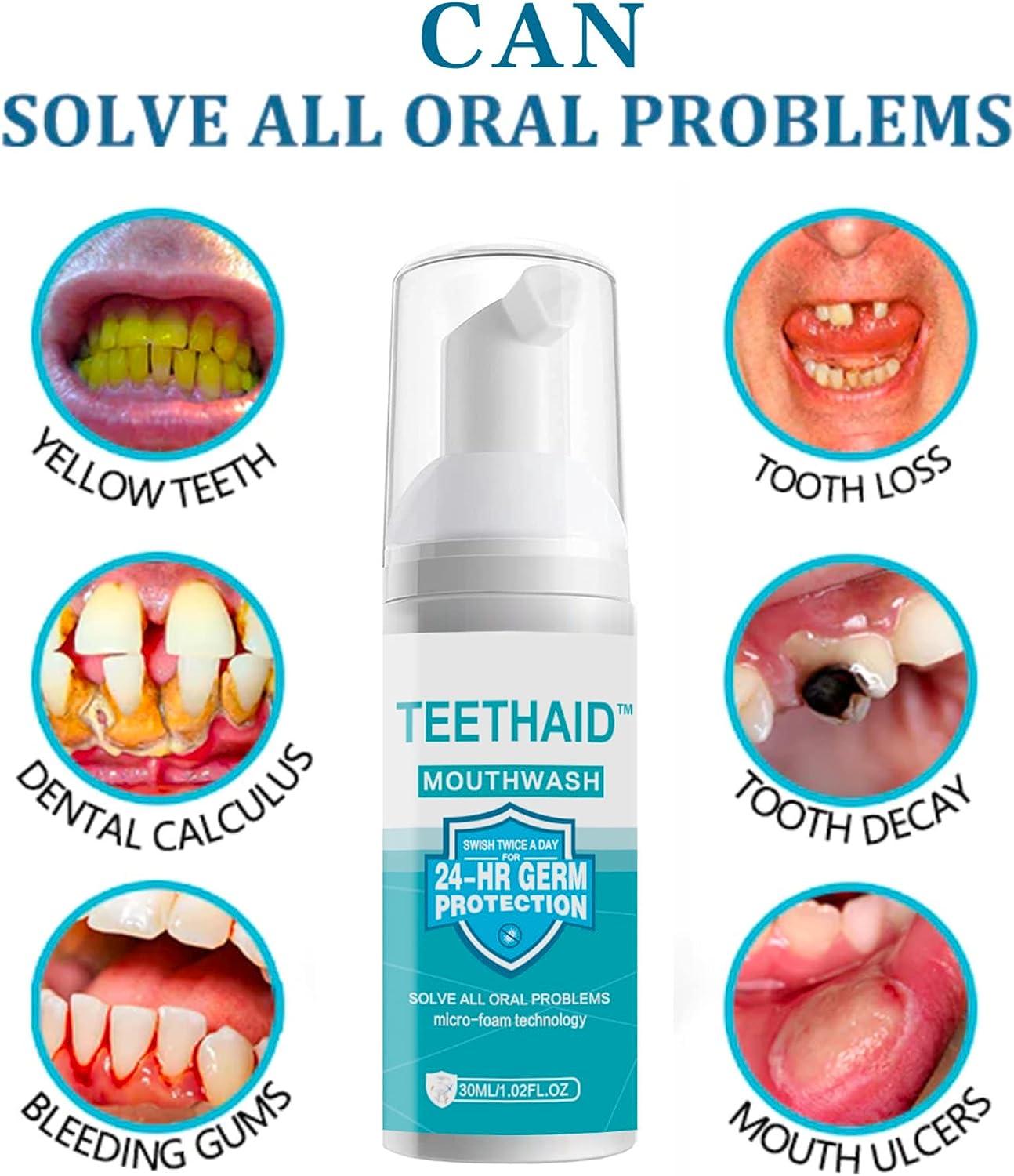 TEETHAID Teethaid Mouthwash Foam Calculus Removal Teeth whitening