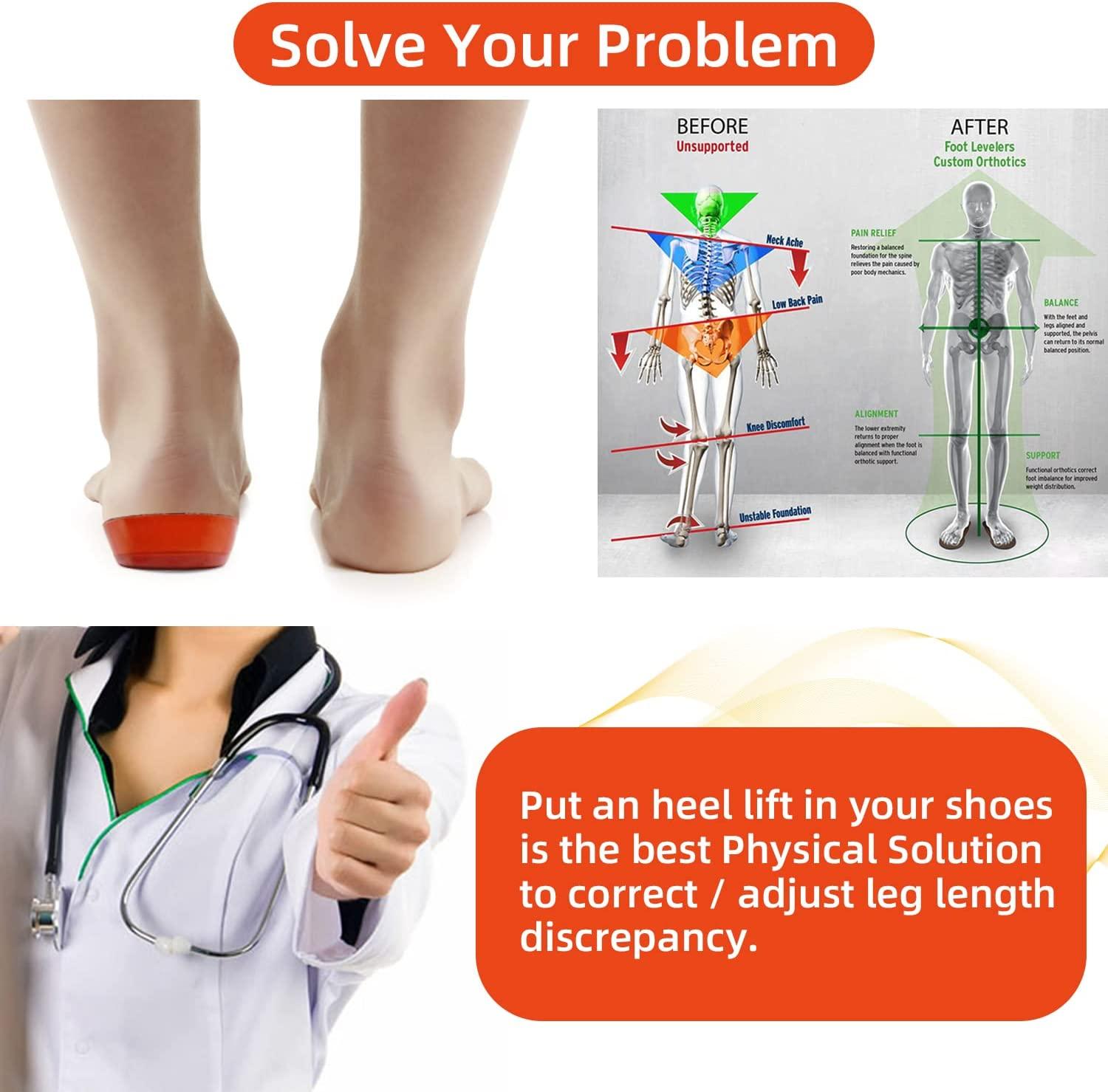 Dr. Satish Kumar - Spiral Accupressure Therapist - Are you suffering from Heel  Pain❓ SPIRAL THERAPY is an instant solution to your problem To book an  appointment Click on 'Send Message' or