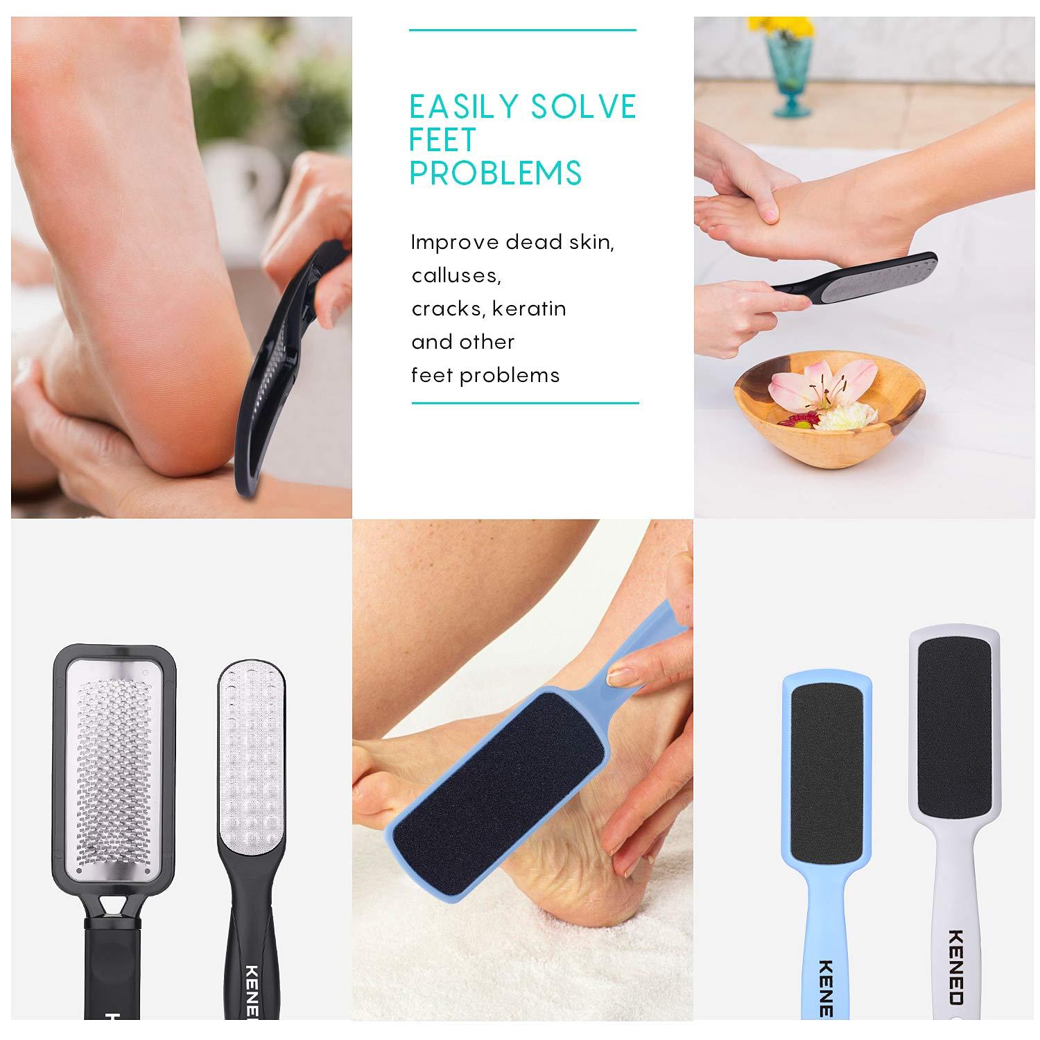 Foot File for Dead Skin - 3 Pack Professional Pedicure Tools Callus Remover  for Feet, Dual-Sided Feet Scrubber Foot Care Products to Remove Callous