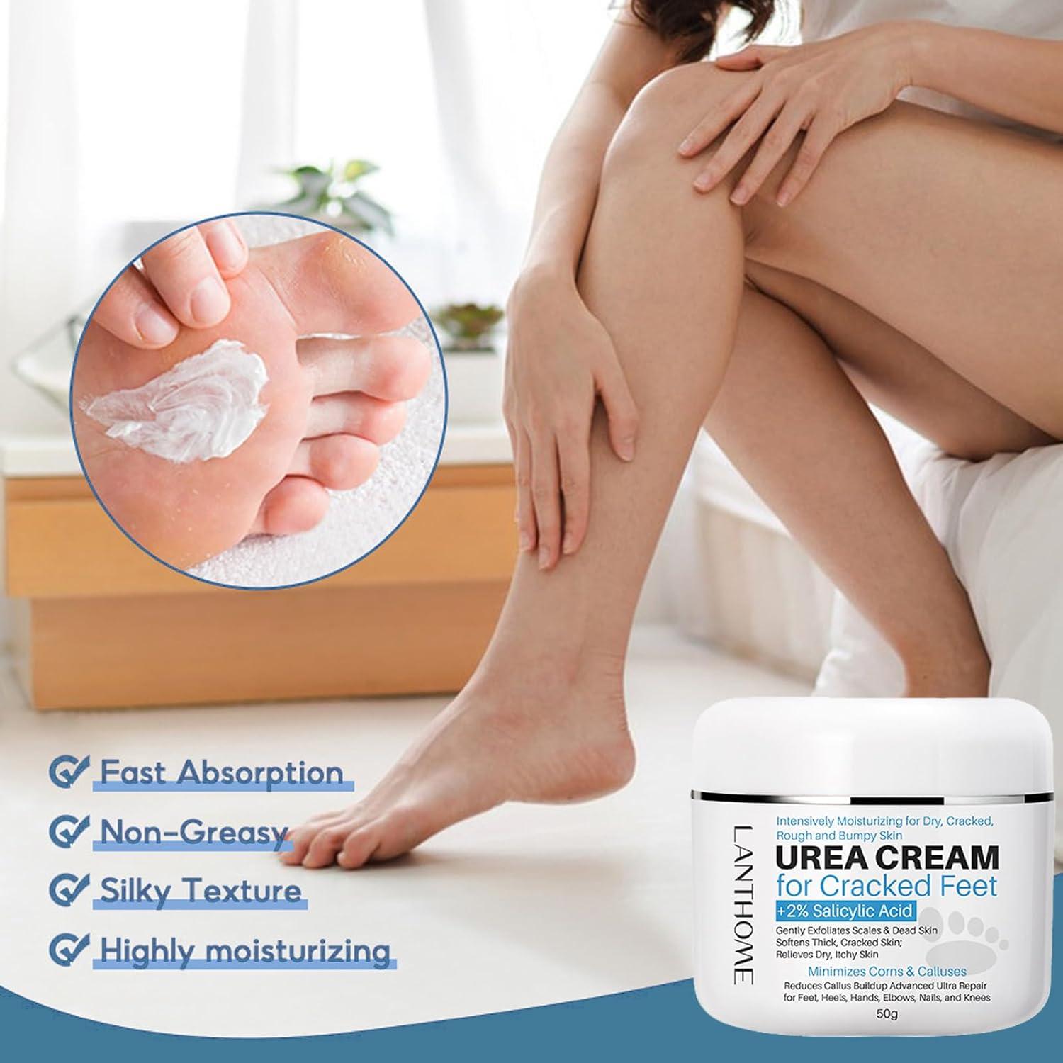Thick Best Cream For Calluses On Feet ND Urea 40% Foot Cream Best