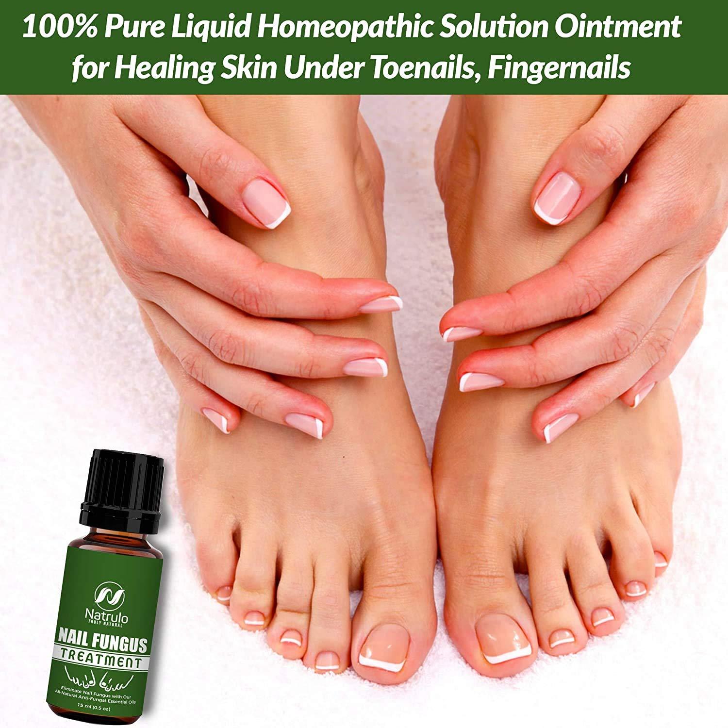 How is Urea used to treat fungal infections of the toe and finger nails? |  MyFootShop.com