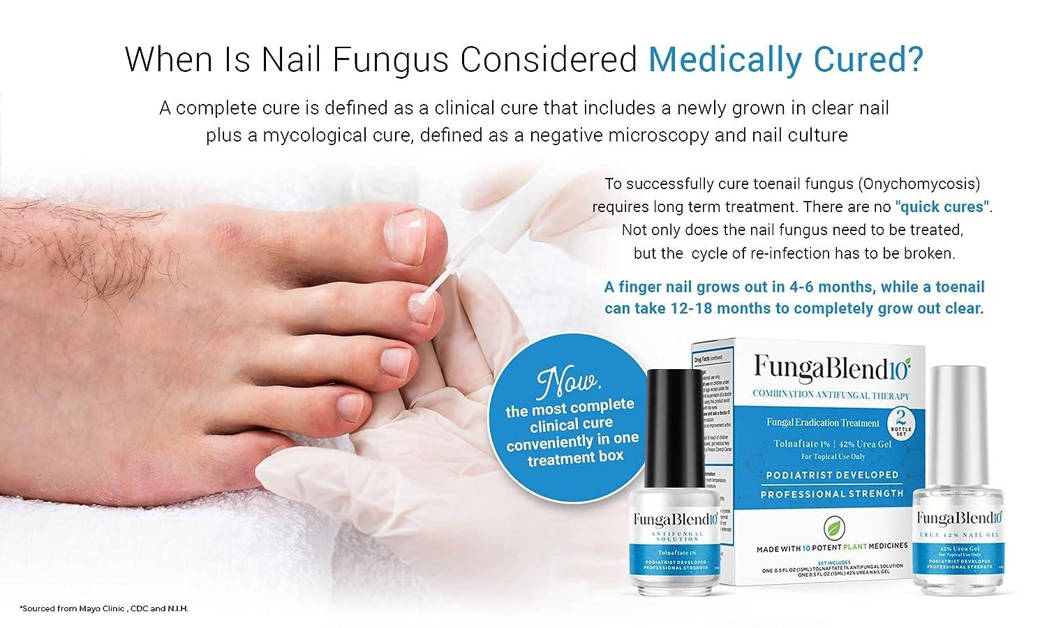 Nail Fungus Treatment Anti Fungal Cream 20g Fungisol Antifungal Nail Repair  Cream Fungisol | Lazada PH