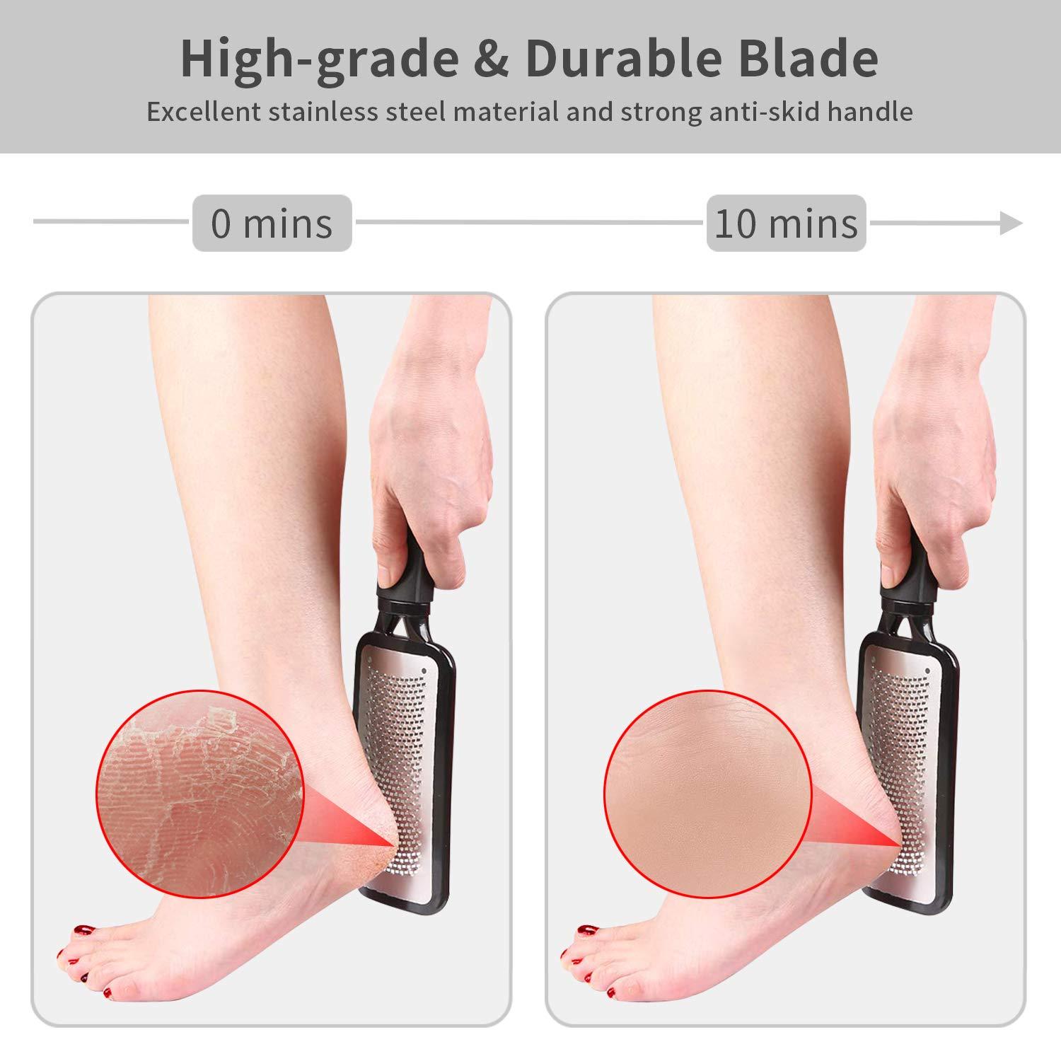 Pedicure Knife Foot Sharpeners, Stainless Steel Pedicure File Foot Care  Remove Hard Skin Callus Foot File,Can Be Used On Both Dry and Wet Feet (C)  - Yahoo Shopping