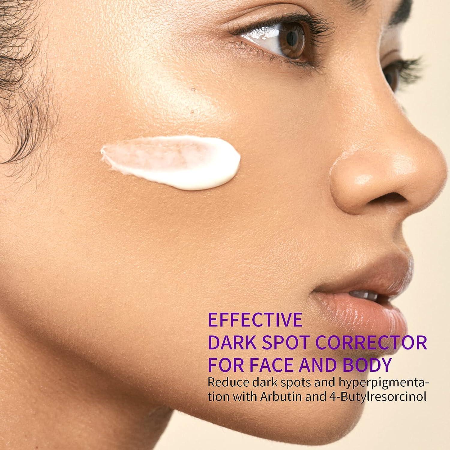 Dark Spot Remover for Face & Body, Age Spots, Sunspot