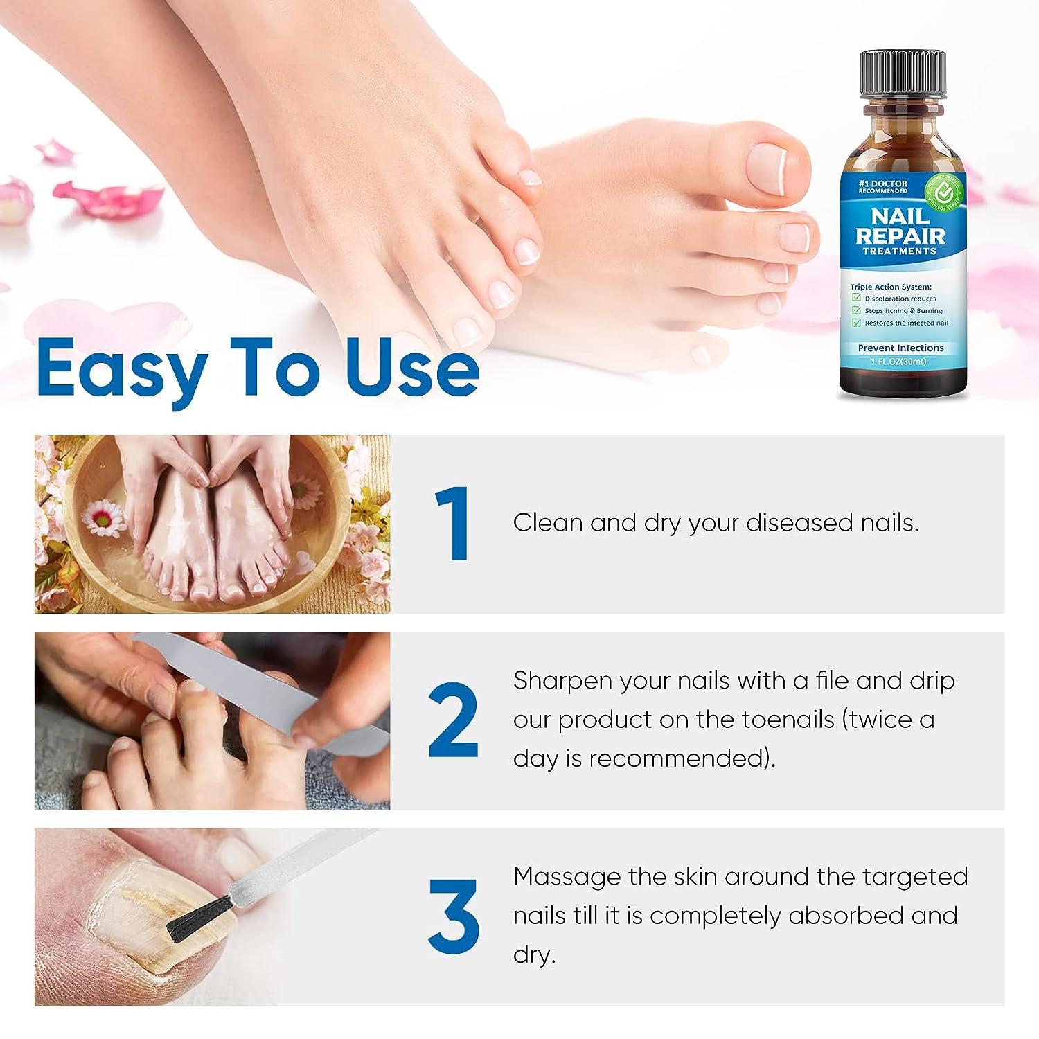 Natural Nail Repair Solution for Damaged, Cracked, and Discolored Nails