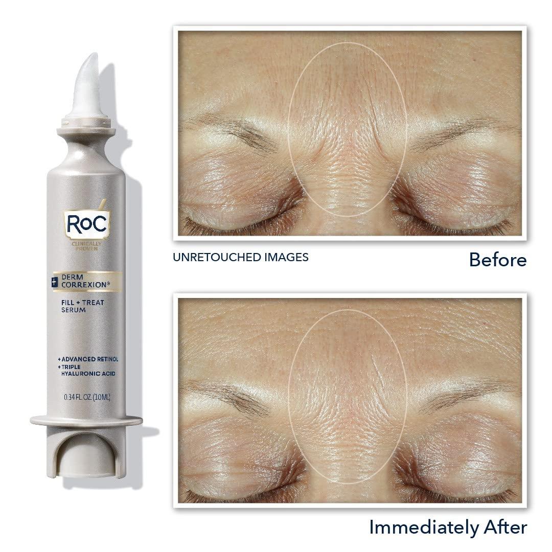 RoC Derm Correxion Fill + Treat Advanced Retinol Serum with Hyaluronic