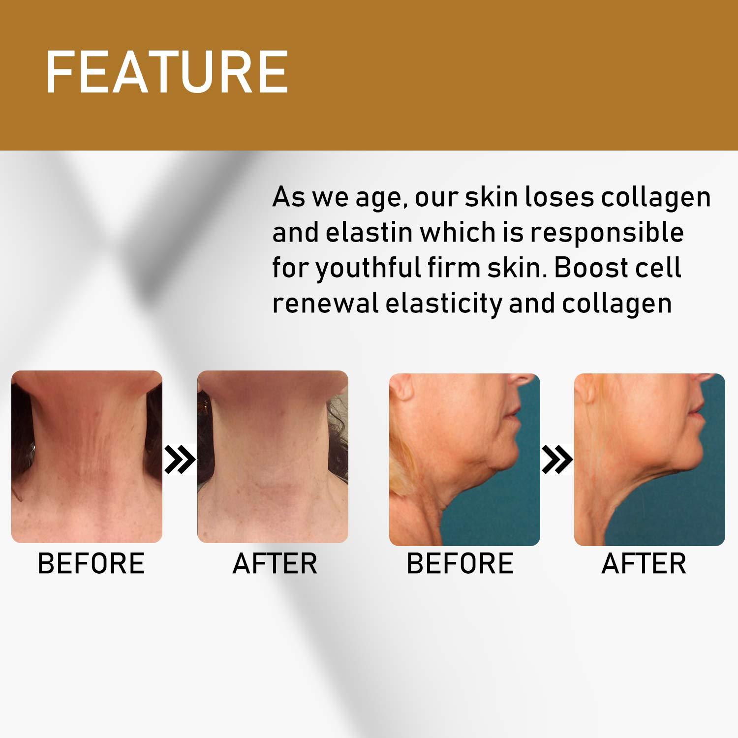 Everlom neck firming cream advanced 65 ml formula for tightening