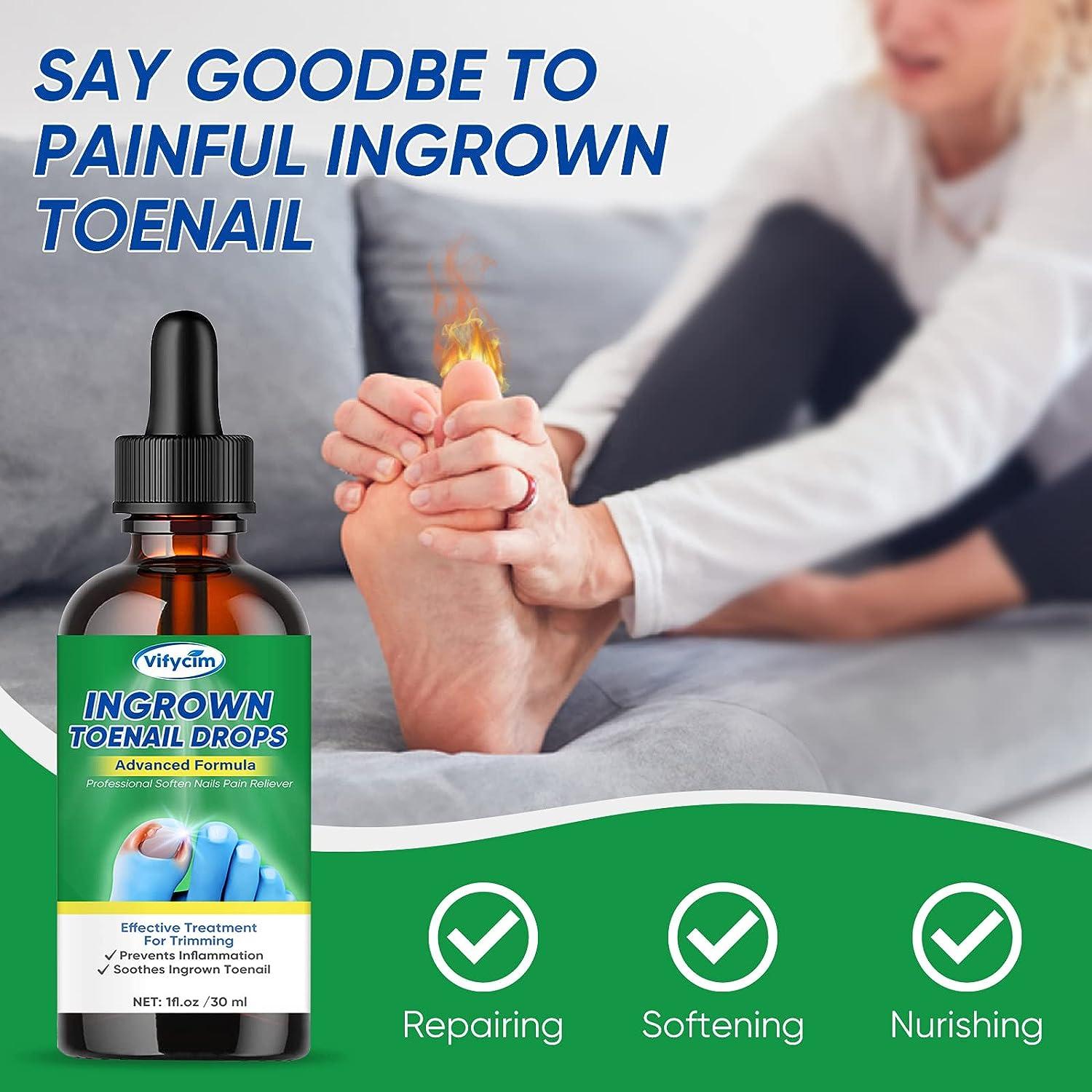 Ingrown Toenail Treatment Ingrown Toenail Corrector Drops Professional