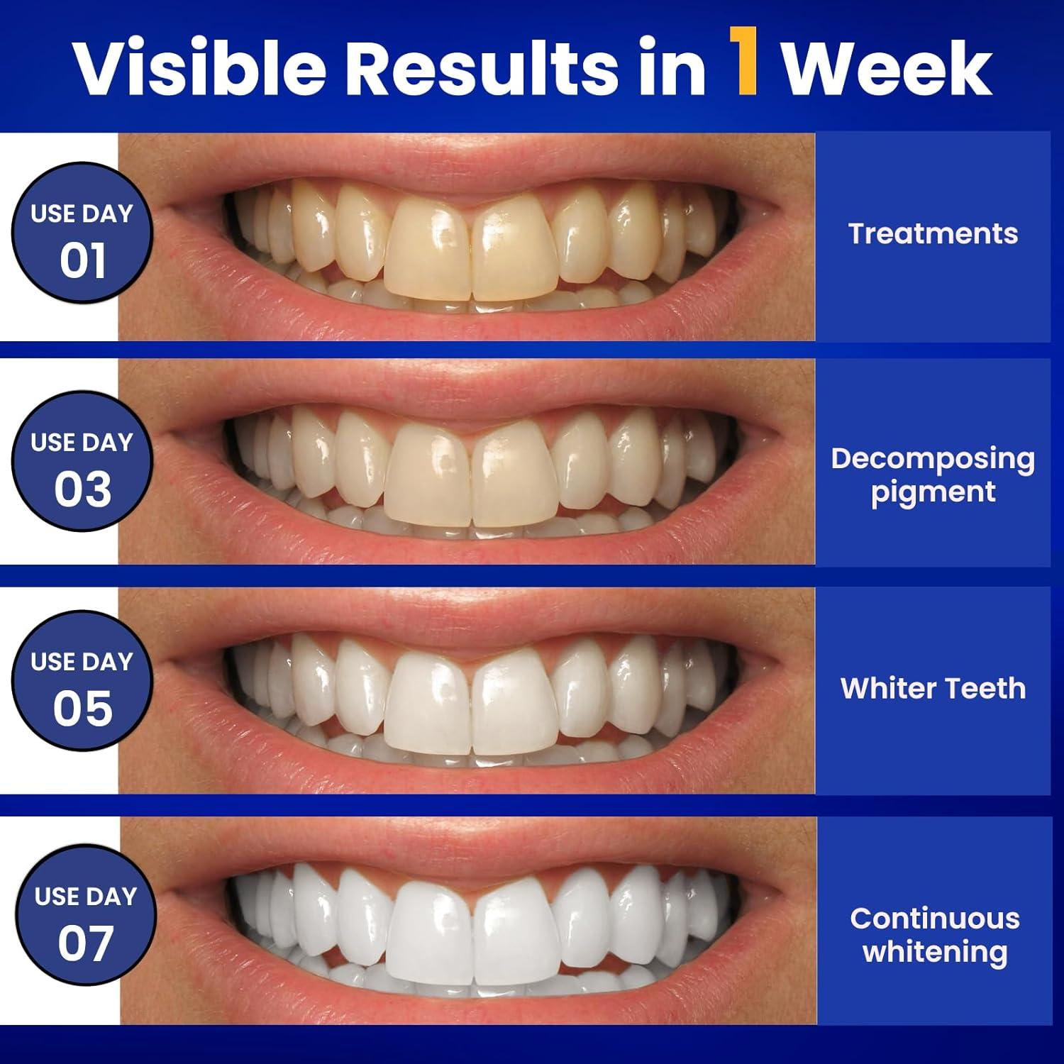 Teeth Whitening Strips Professional Teeth Whitening Strip 28 Strips 14