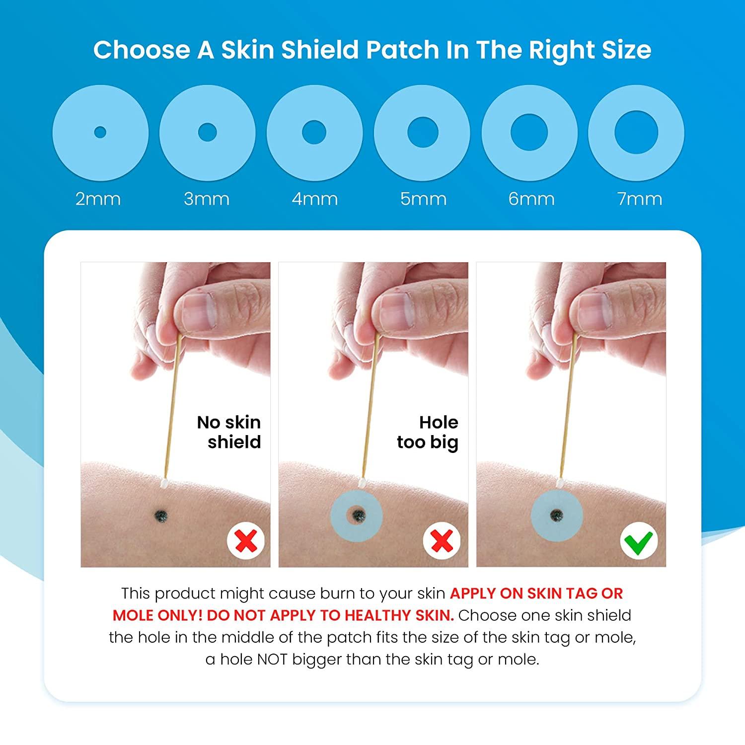 Upgrade Skin Tag Remover Kit for Men & Women 36 Skin Shields & Repair