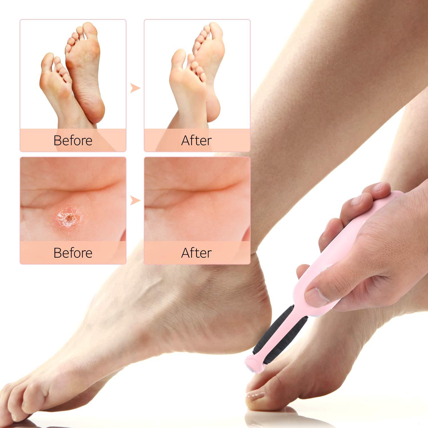 ENCHEN Foot Dead Skin Callus Remover Electric Pedicure Foot Care