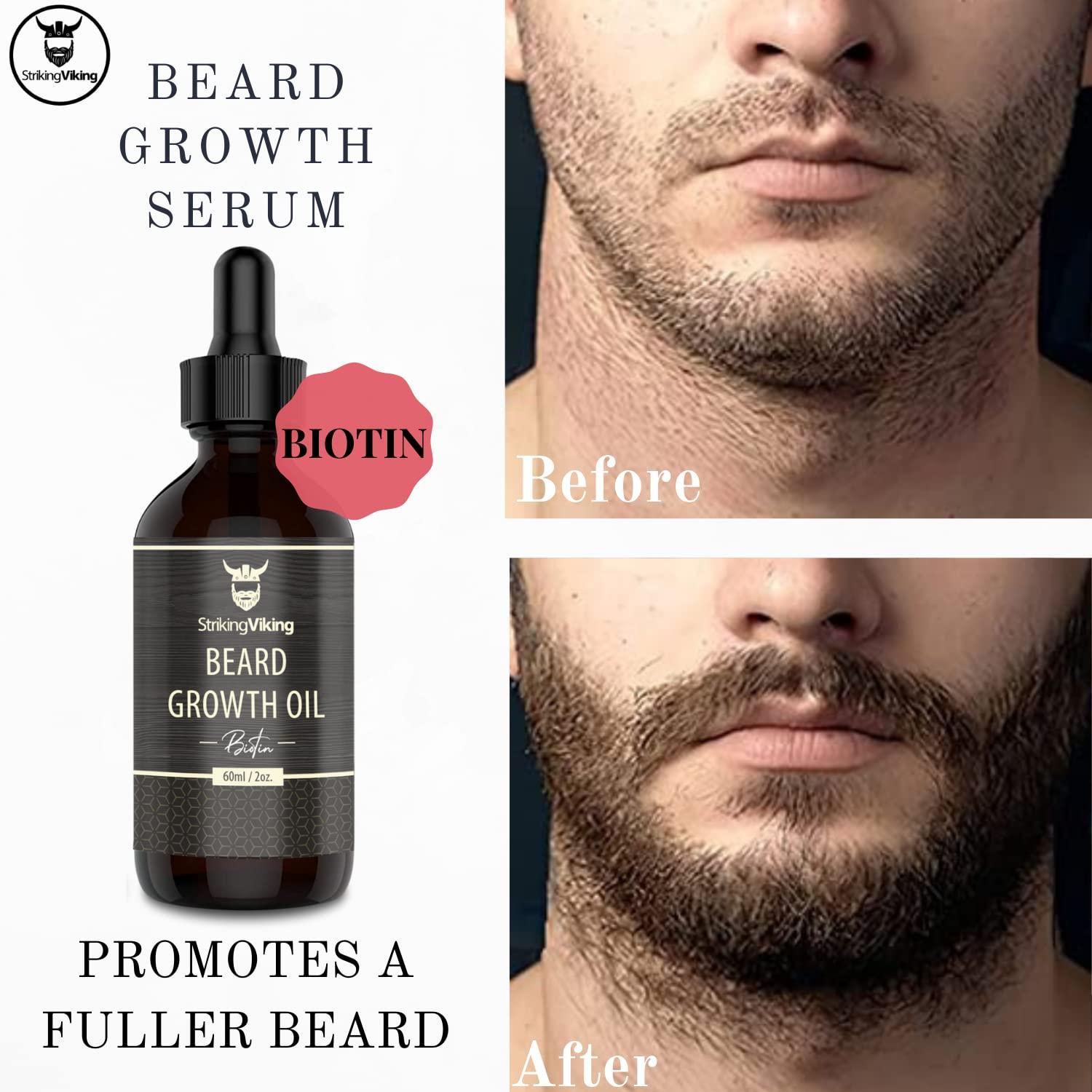 Beard Growth Oil with Biotin – Thickening and Conditioning Beard Oil - All  Natural Beard Growth Serum Promotes Facial Hair Growth for Men by Striking  Viking, Vanilla Vanilla 2 Fl Oz (Pack of 1)