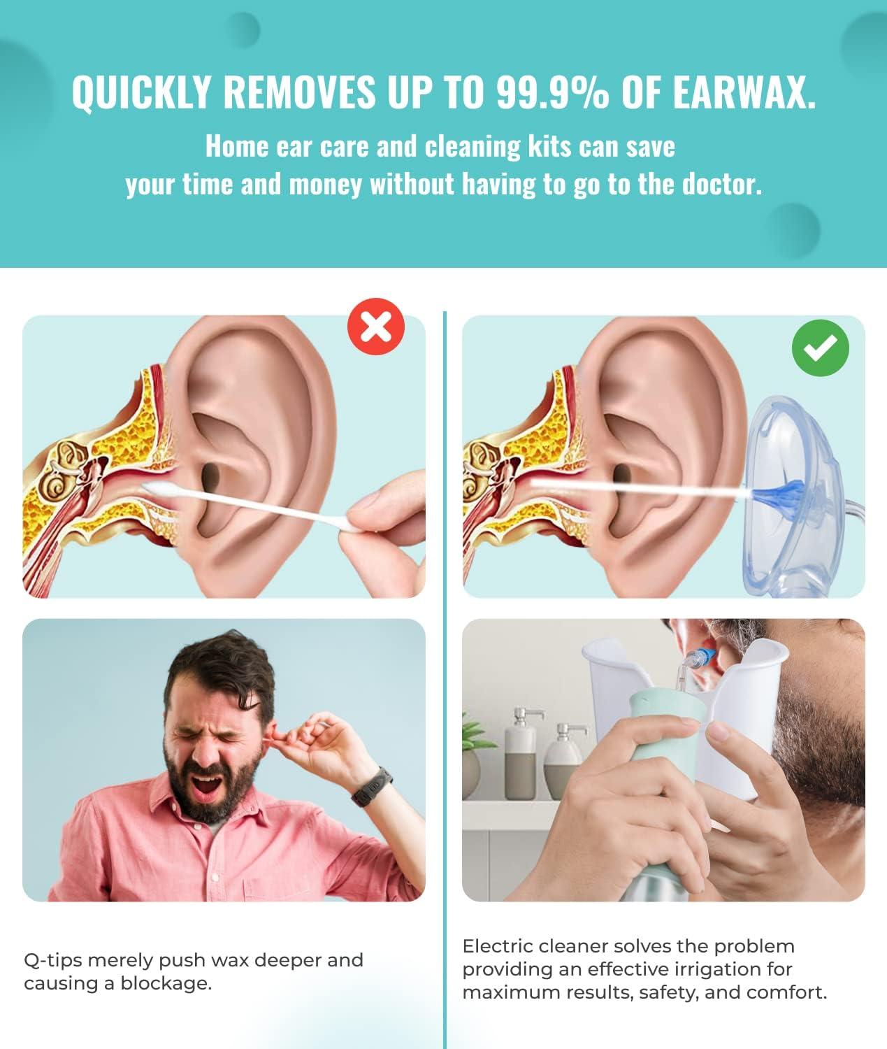 AngelsTD Electric Ear Wax Removal Ear Irrigation Water Cleaner Kit Noise  Reduction Earwax Removal Tool Safe and Easy Ear Wash with 4 Pressure Levels  Water Resistant Ear Basin