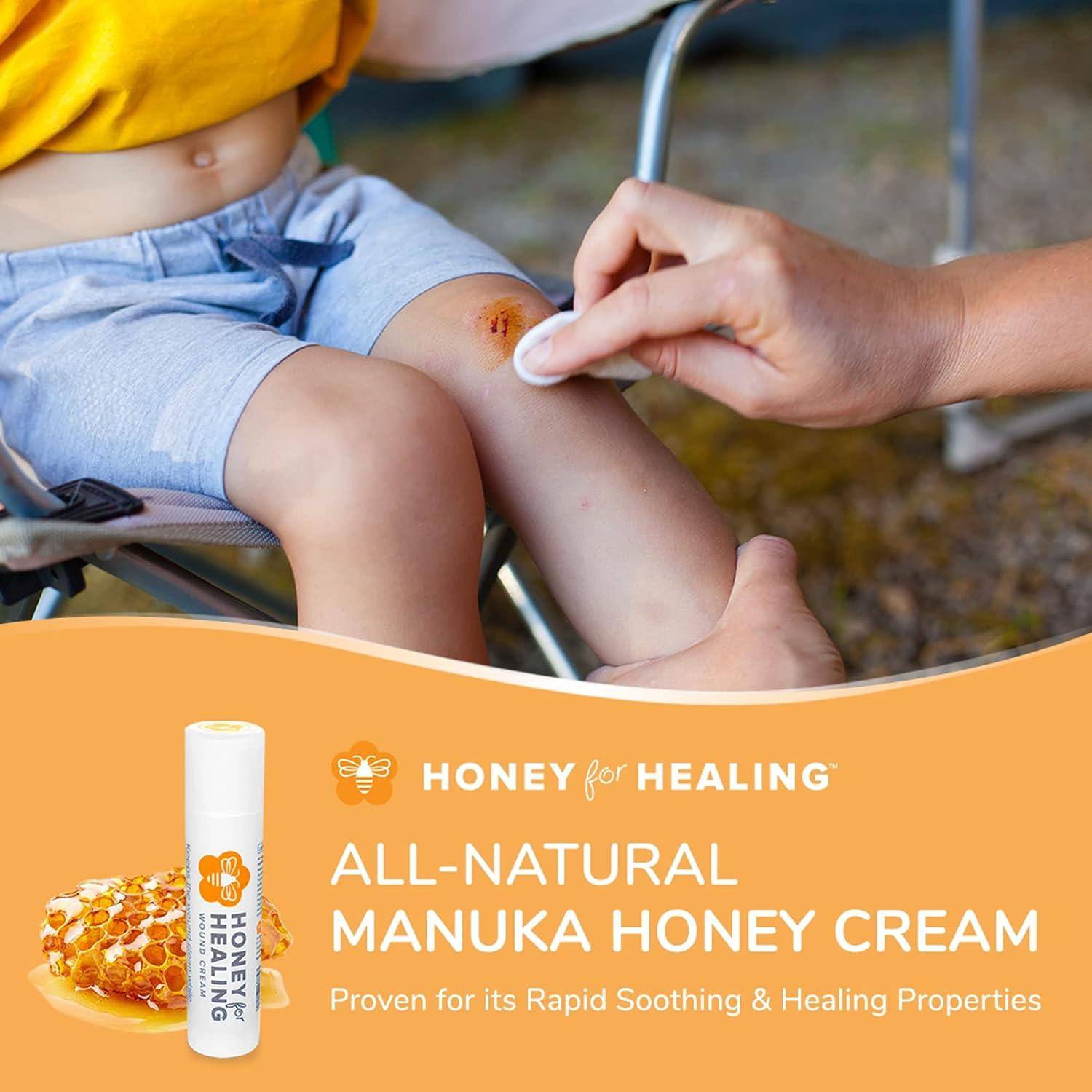 Manuka Honey Ointment for Burns and Wounds