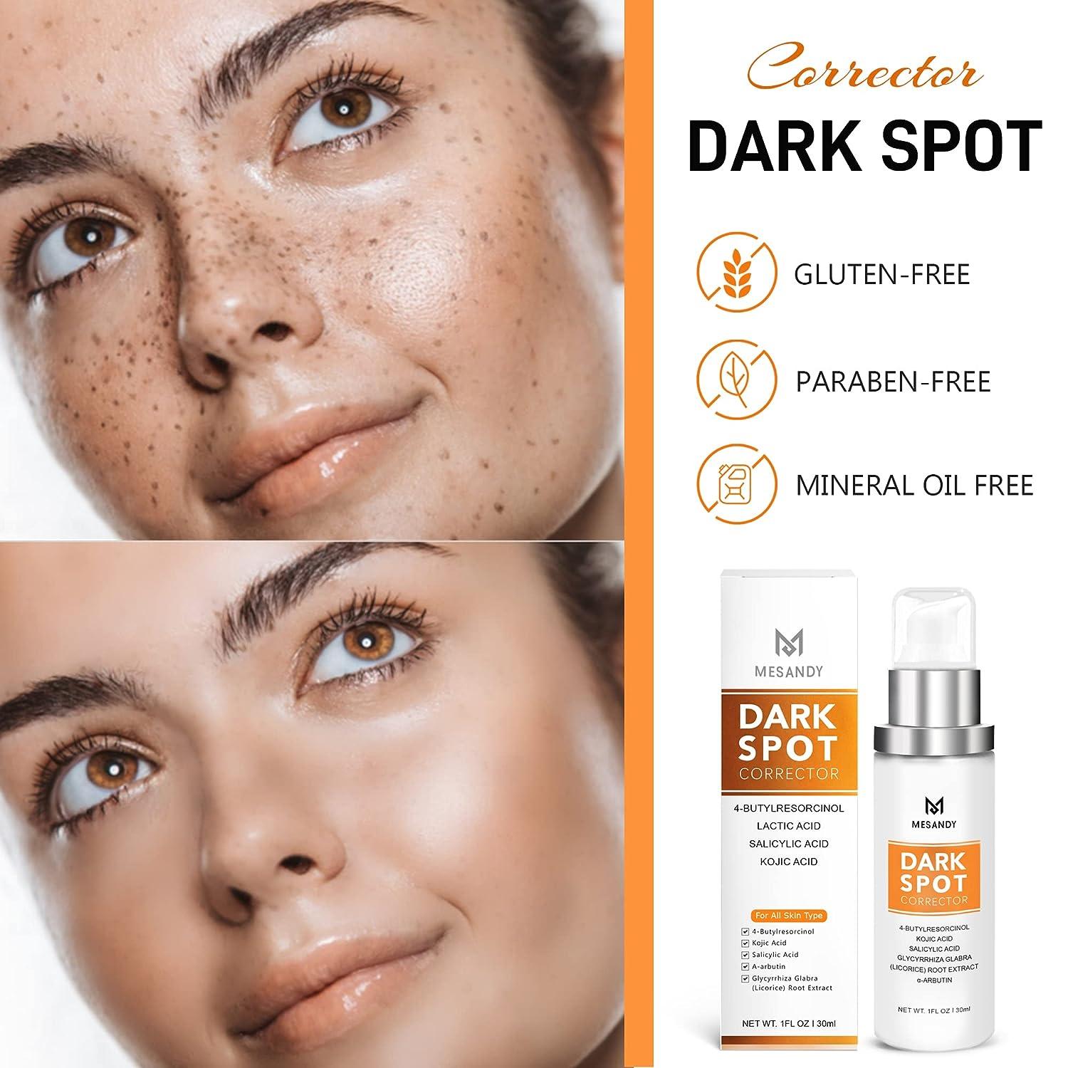 Dark Spot Remover for Face, Dark Spot Corrector for Face, Day & Night Sun  Spots, Age Spot and Freckle Remover with Vitamin C & Hyaluronic Acid ,  4-Butylresorcinol, Kojic Acid, Lactic Acid