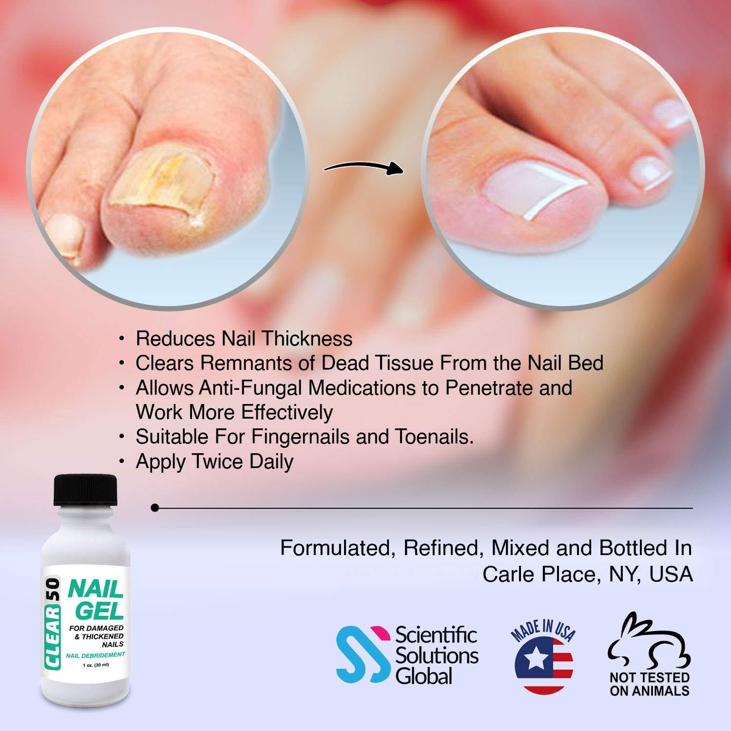 Clear 50 Nail Gel 1 oz Hard Nail Softener with 50 Urea Quick