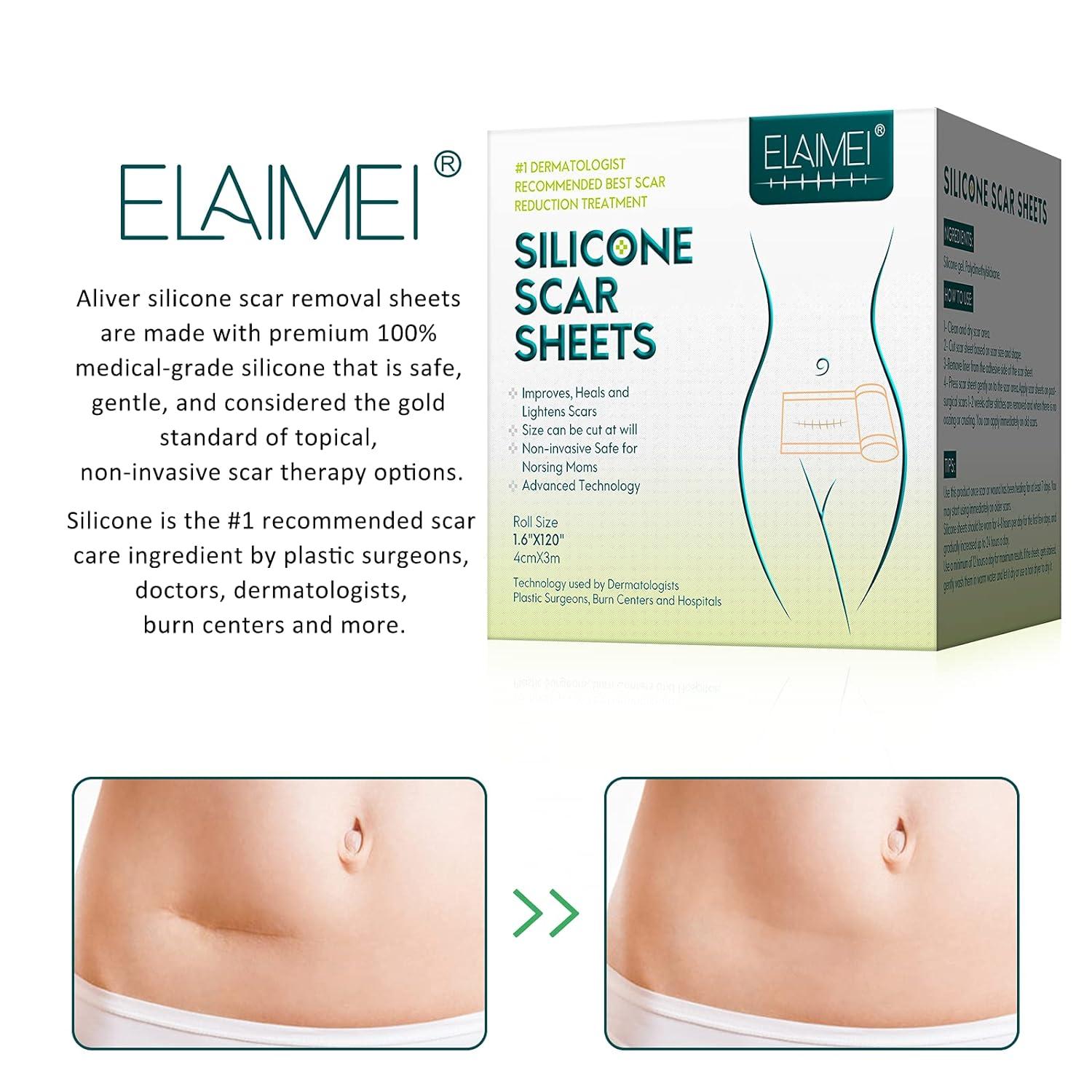 Silicone Scar Tape Medical Grade - 1.6 X 120 Inch Roll For Surgical & C-Section Scars Tuck Tape - View #6