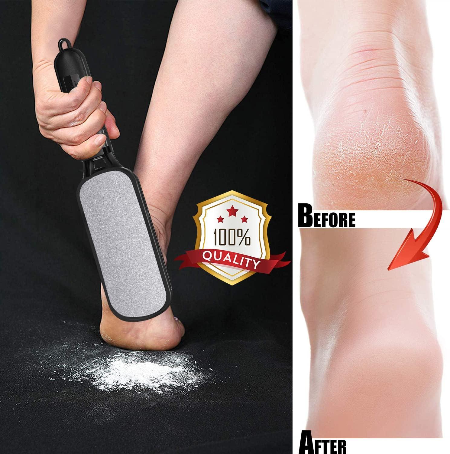 Foot File Callus Remover for Feet Double Sided Foot Scrubber for Dead Skin  Remover Foot Rasp Pedicure Tool to Remove Hard Skin Callus Plantar Wart  Corn - Skin-Friendly Metal Foot File