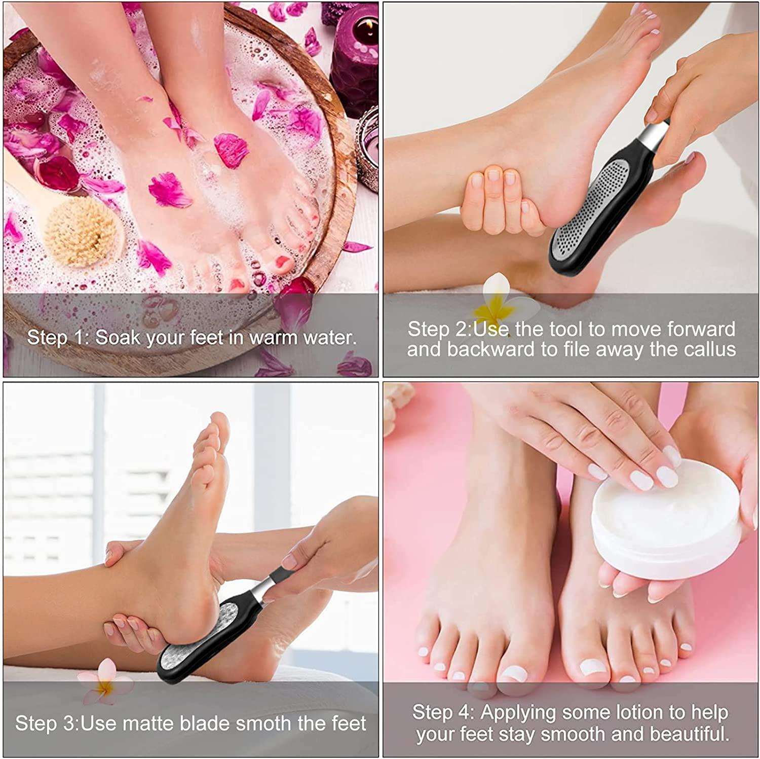 Callus Shaver Set Stainless Steel Foot Dead Skin Removal (Rose