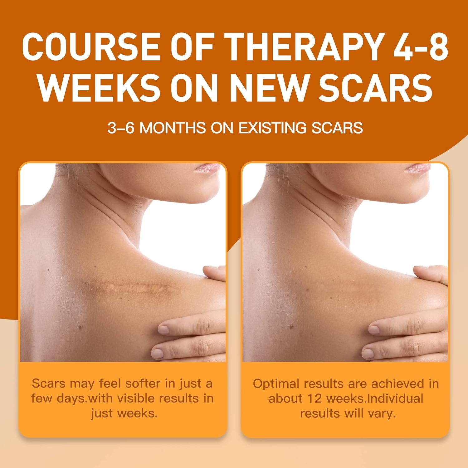 Medical Grade Silicone Scar Sheets Breathable Silicone Scar Tape Roll