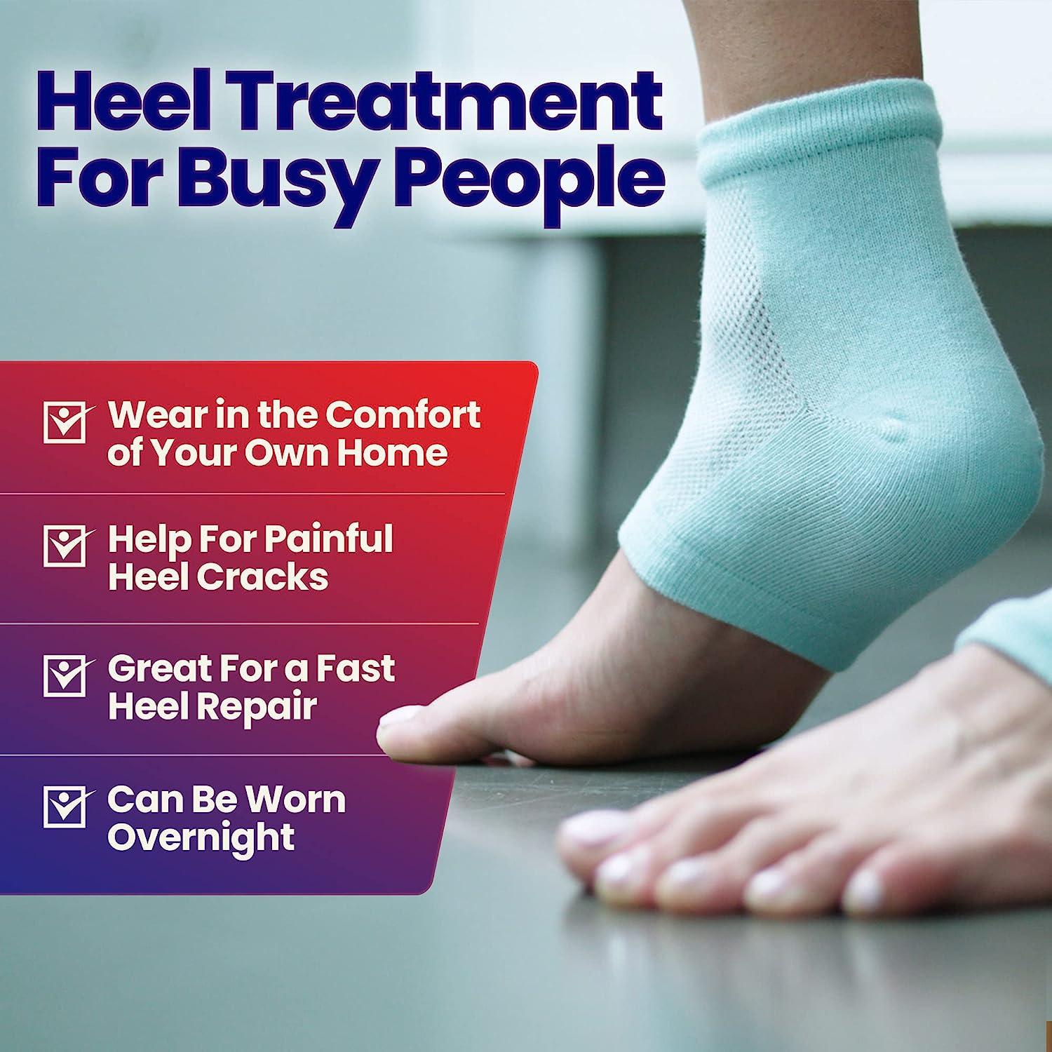 Happy Feet: How To Combat Dry Skin & Cracked Heels - NZ Herald