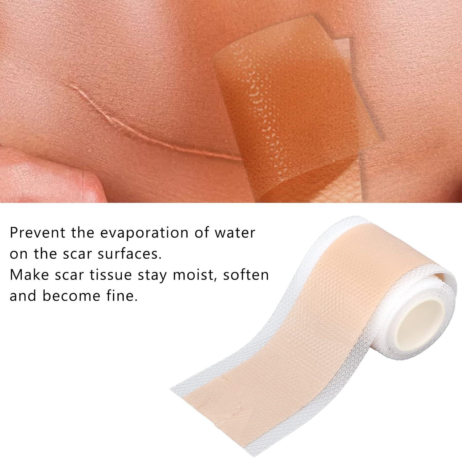 Scar Removal Tape Reduce Hyperplasia 59.1in Scar Tape Roll Improve