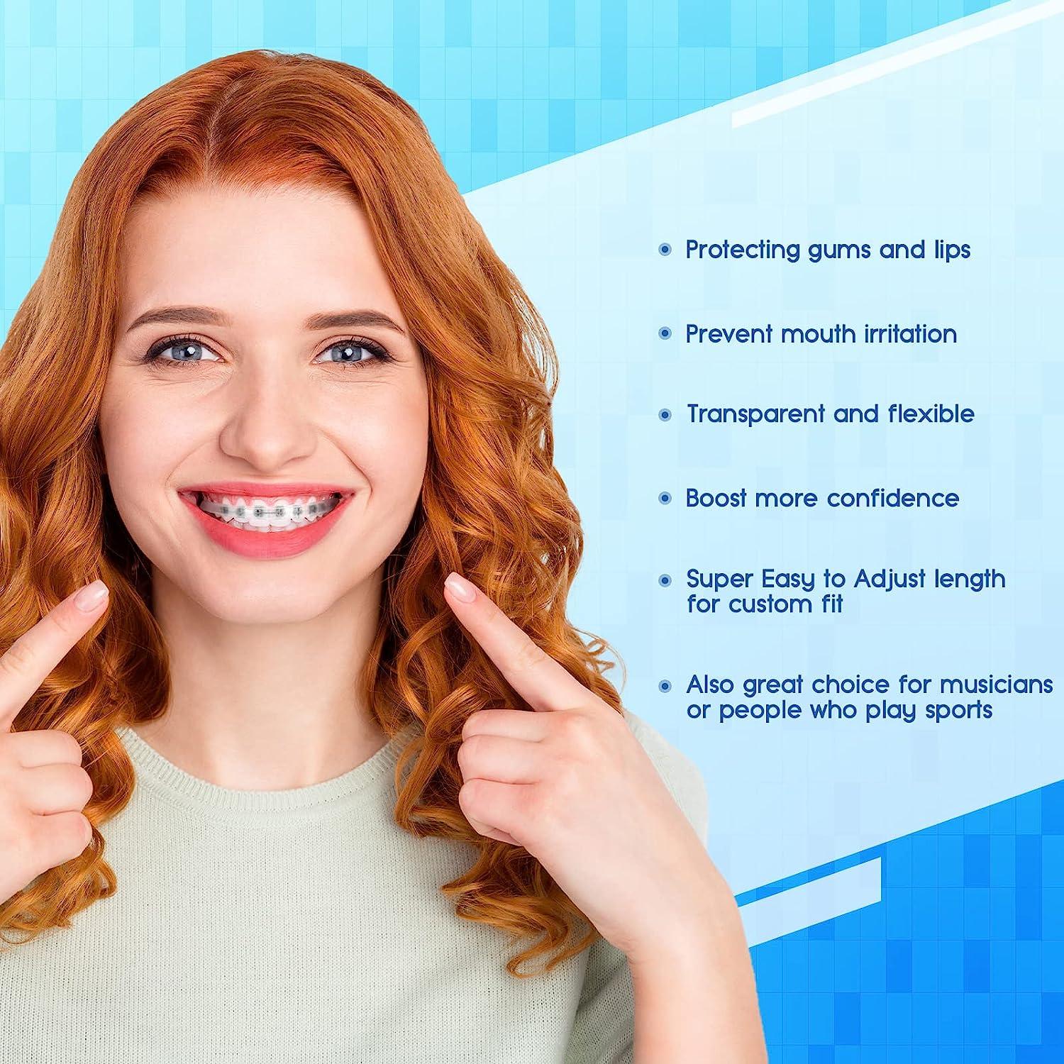 Obrush Clipon Comfort Covers for Braces Orthodontic Lip Protector