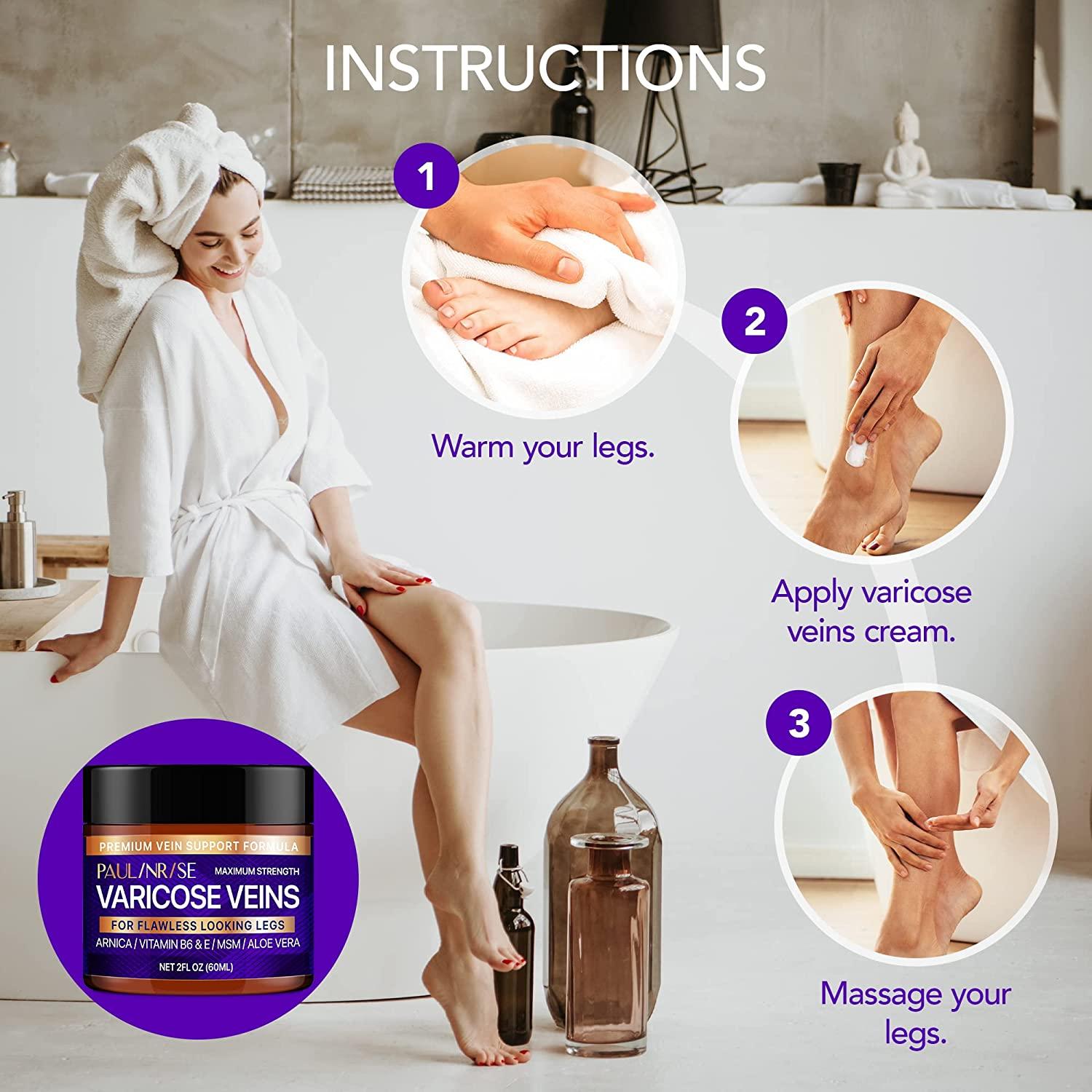 Natural Varicose Veins Cream for Pain Relief Effective Treatment for