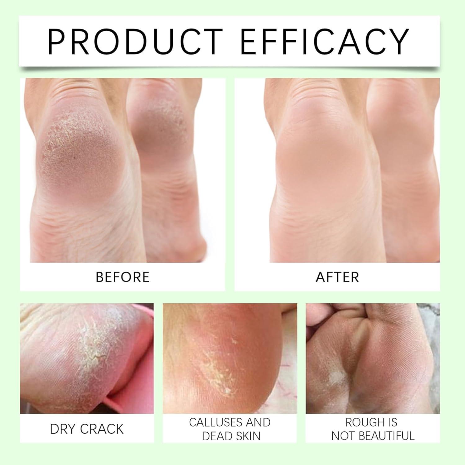 Foot Cream for Cracked Heels and Dry Skin Avocado Foot Cream Stick