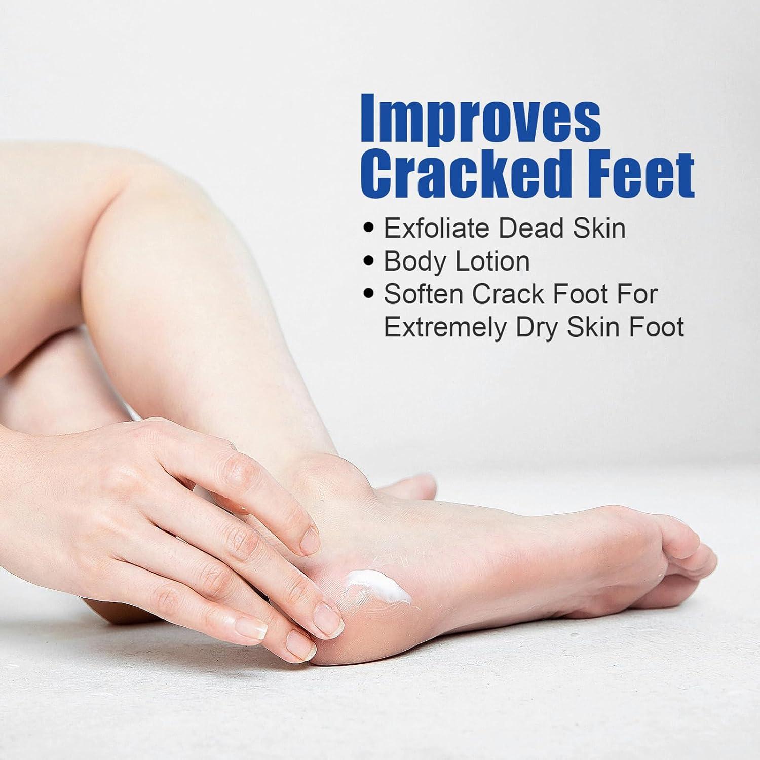 Urea Foot Cream Cracked Heel Repair Cream Foot Cream for