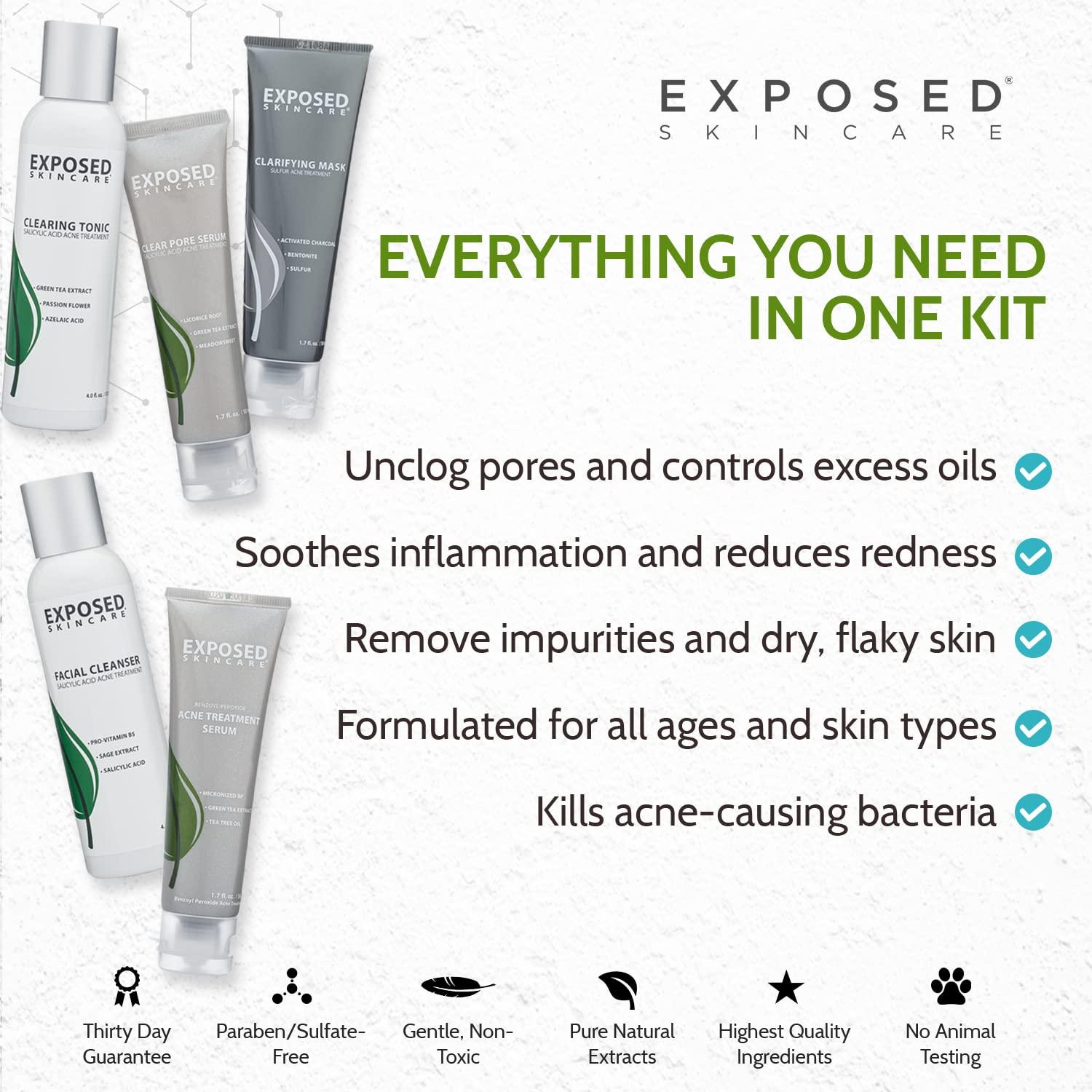 Exposed Skin Care Acne Treatment Kit Includes Facial Cleanser, Clearing Tonic, Acne Treatment