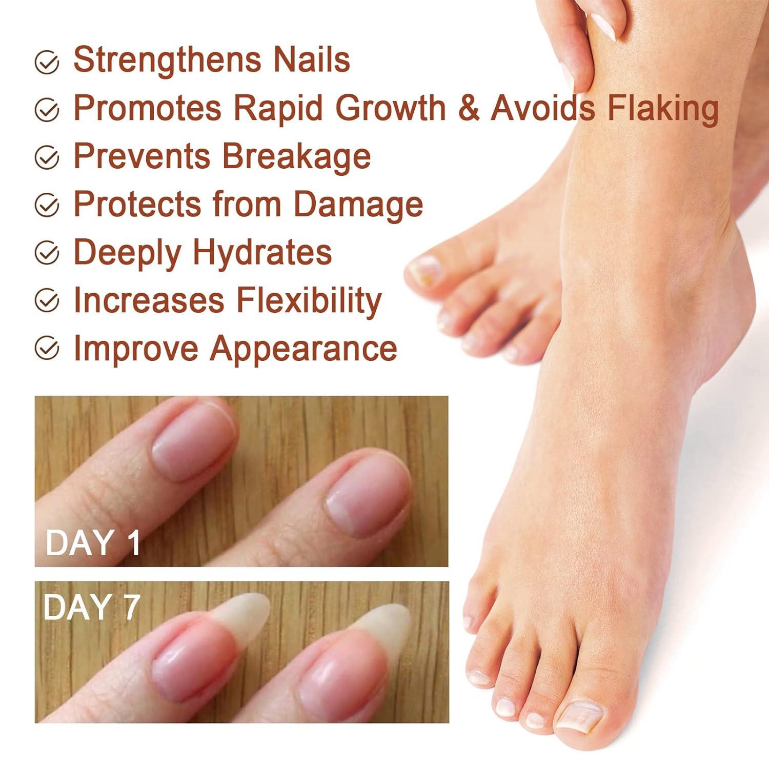 Nail Growth Serum,Nail Growth Treatment,Nail Growth And Strengthening –  TweezerCo