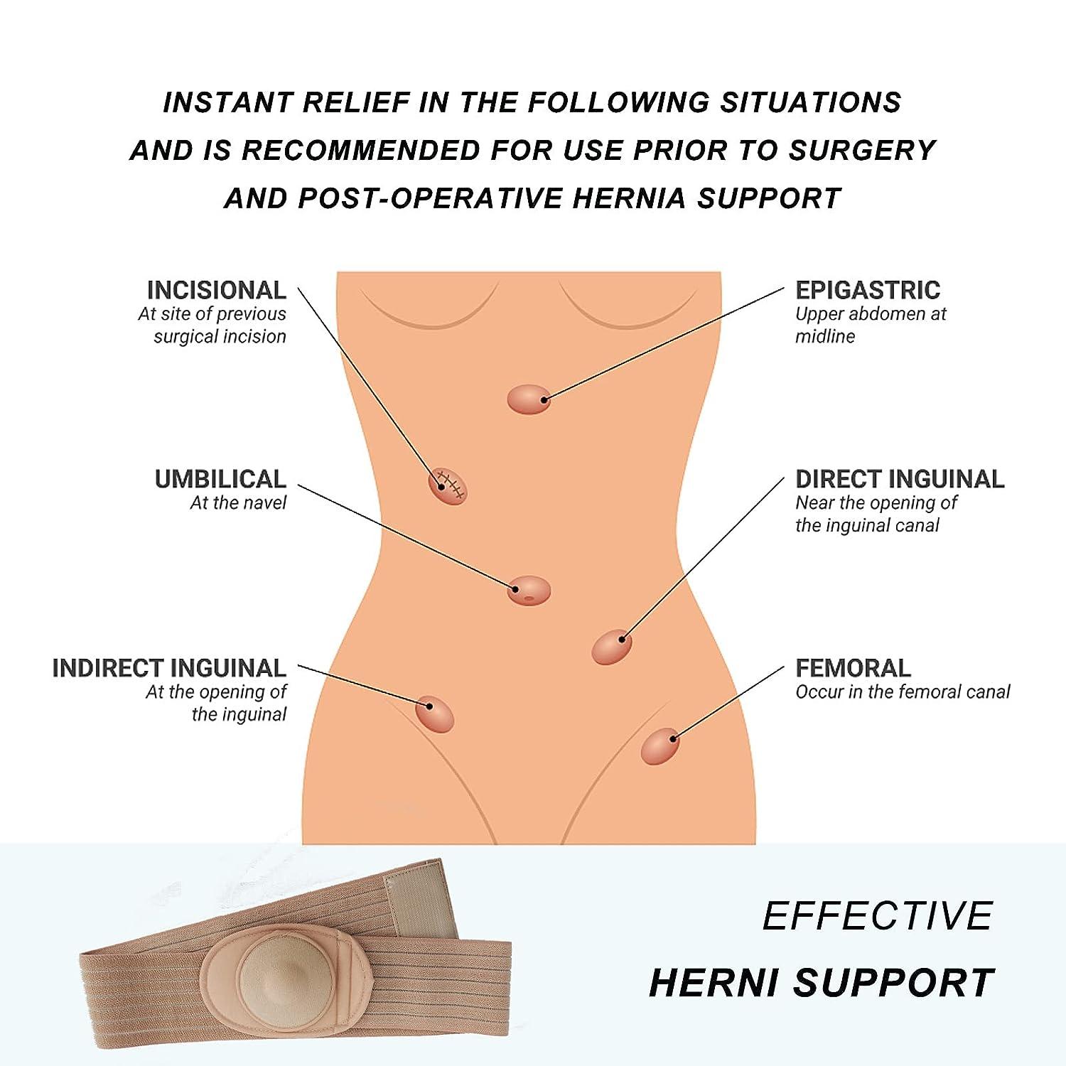 HEERTEEAJ Umbilical Hernia Belt, Abdominal Hernia Belt for Men & Women, Belly  Button Umbilical Hernia Binder w/ 1 Hernia Compression Pads