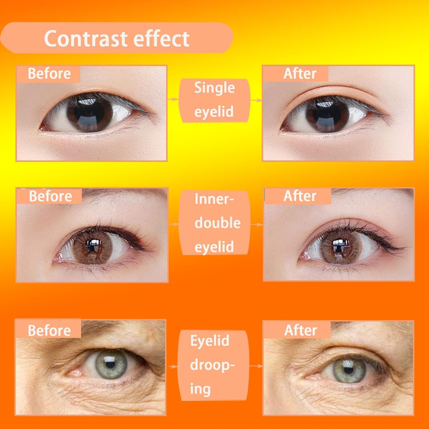 Double eyelid hot sale vs single eyelid