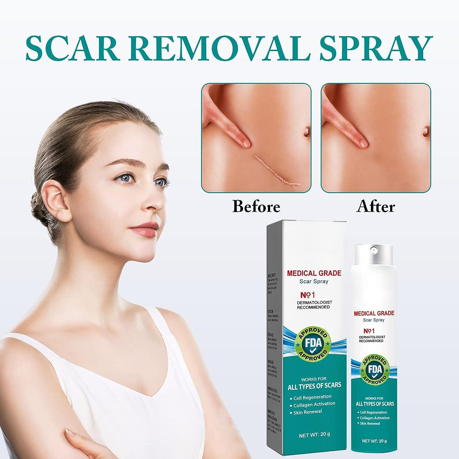 PARHAR Advanced Scar Repair Spray For Facial Acne, Dark Spots