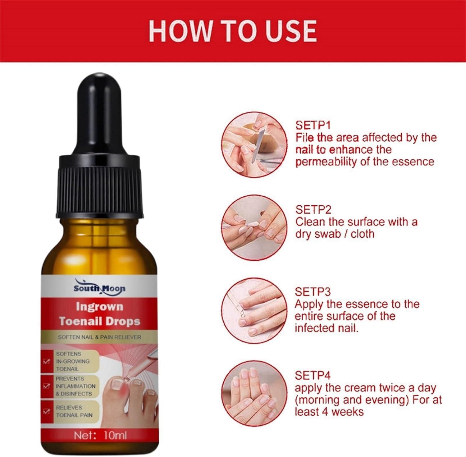 Ingrown Toenail Treatment Treatment for Ingrown Toenail Anti Paronychia