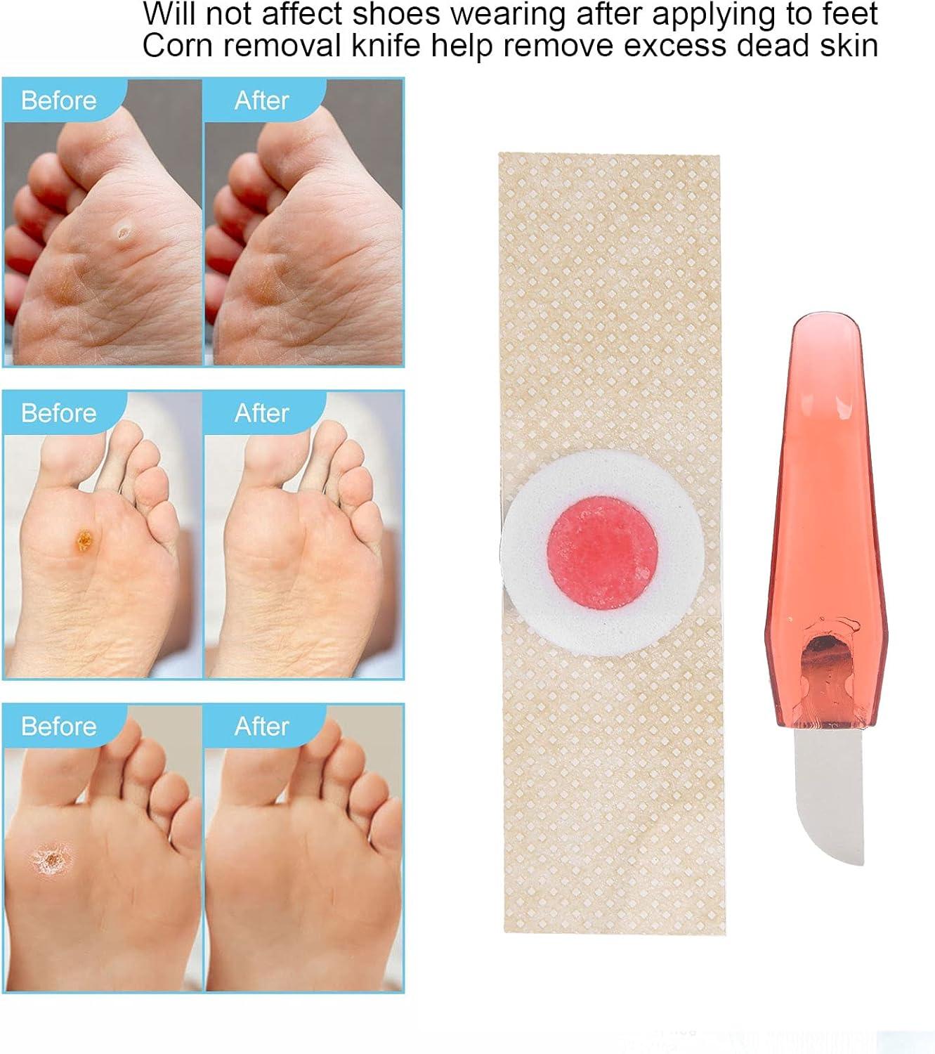 Toe Corn Remover Sticker Compact Foot Corn Pad for Home Use