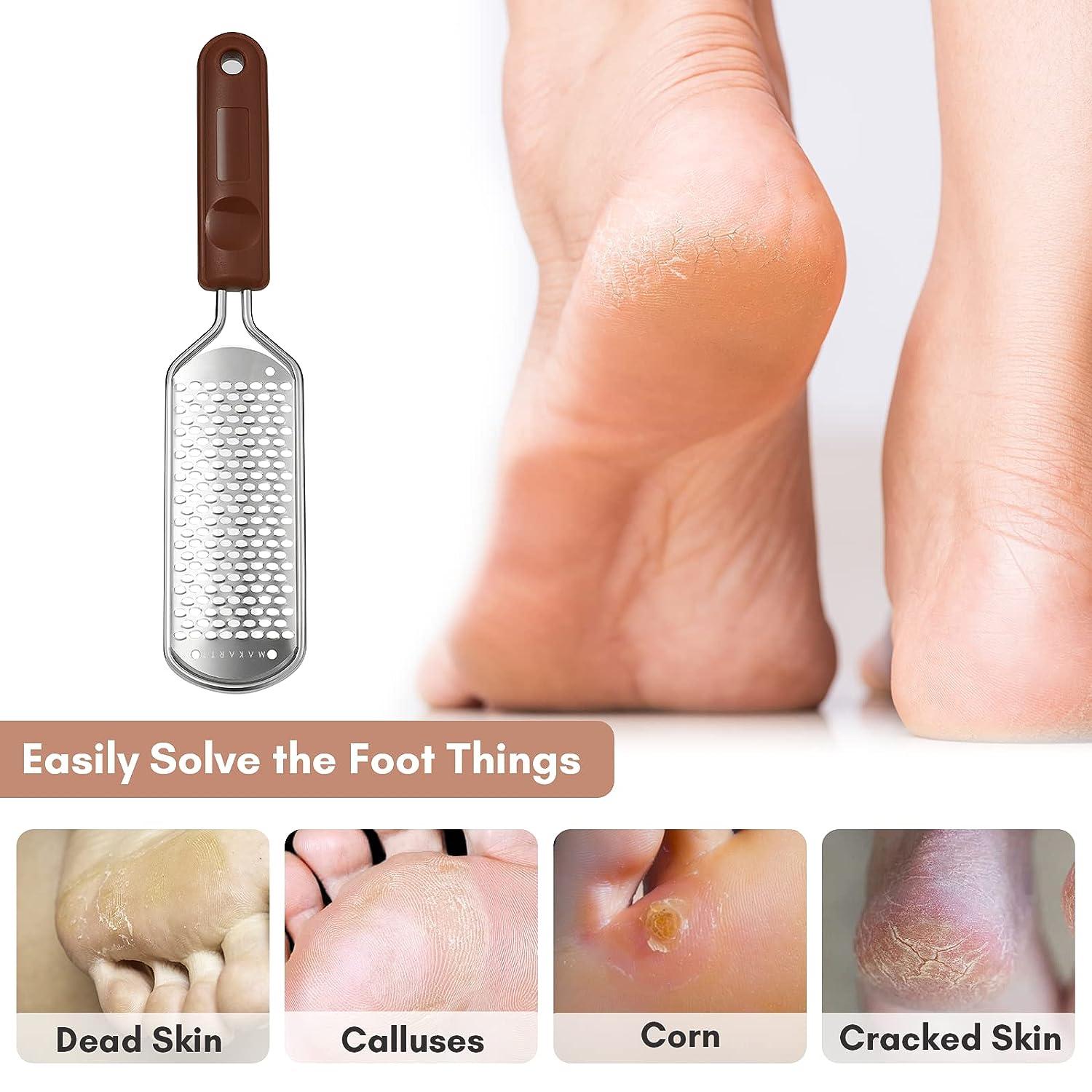 Stainlesssteel Foot File, Professional Pedicure Metal Tool Heel Foot  Scraper For Dead Skin, Callus, Cracked Heels, Hard Skin Remover (black)