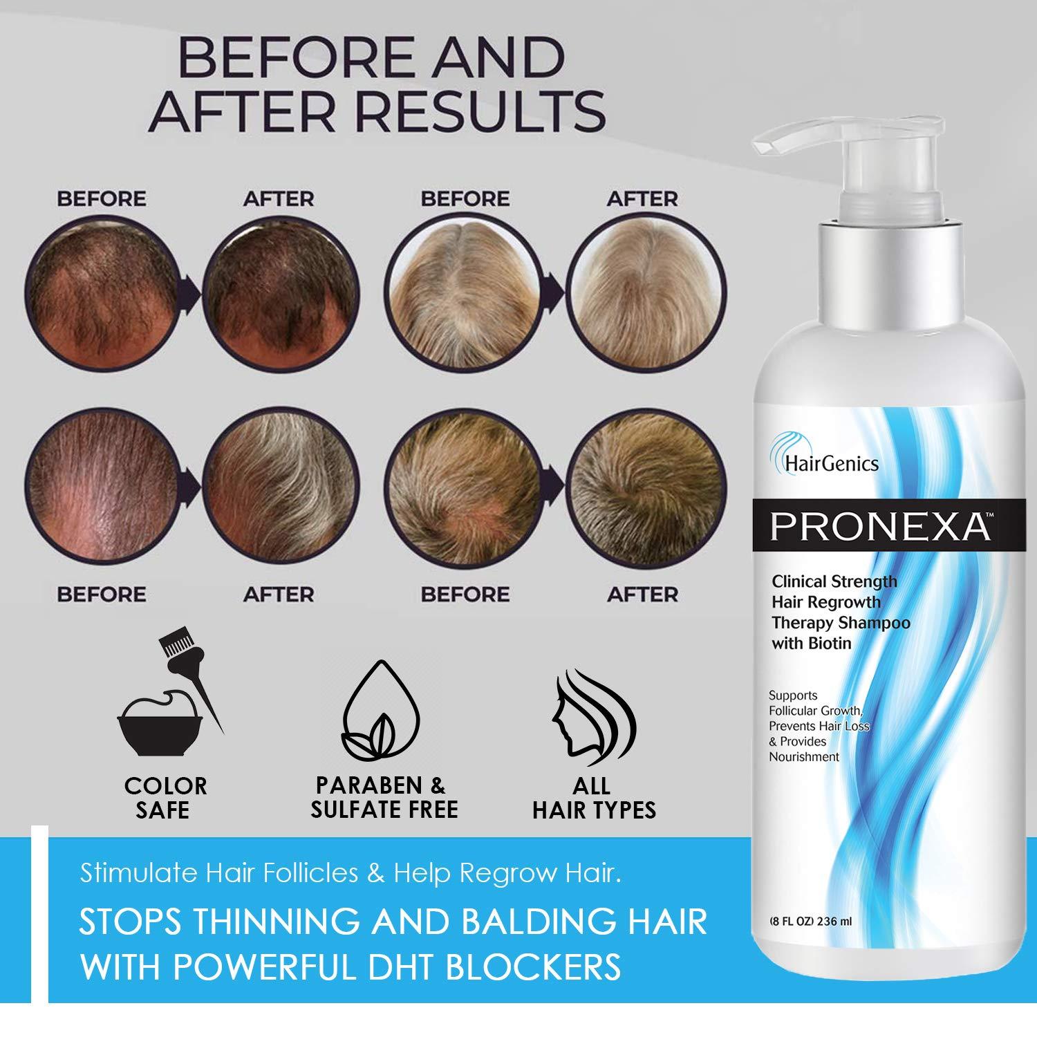 Hairgenics Pronexa Clinical Strength Hair Growth & Regrowth Therapy Hair  Loss Shampoo With Biotin, Collagen, and DHT Blockers for Thinning Hair, 8  fl. oz.